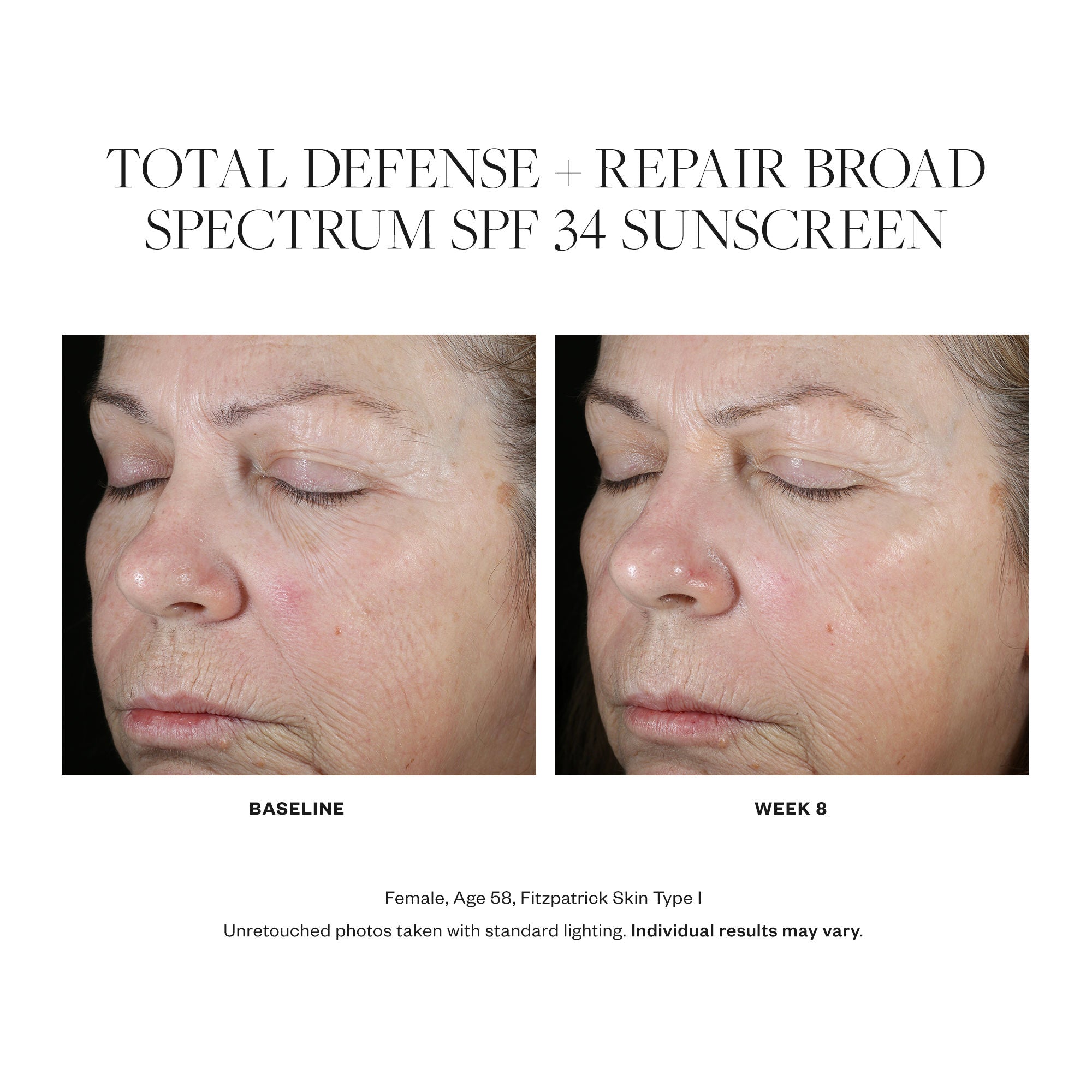 Total Defense + Repair Broad Spectrum SPF 34 Sunscreen