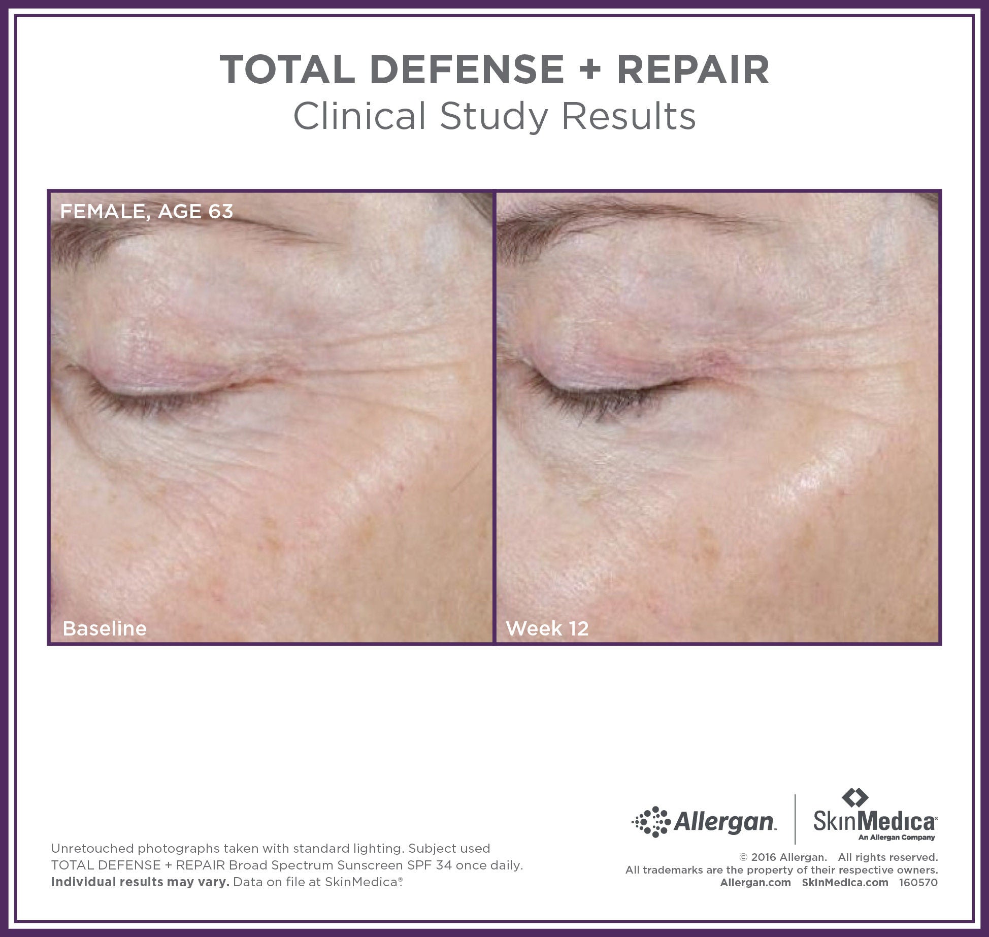 Total Defense + Repair Broad Spectrum SPF 34 Sunscreen