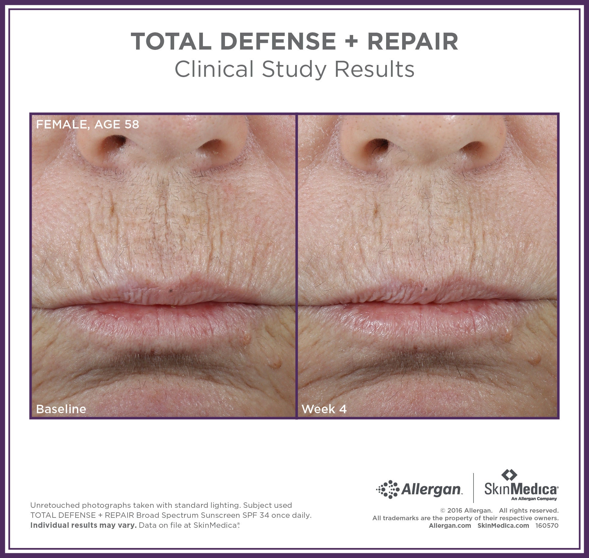 Total Defense + Repair Broad Spectrum SPF 34 Sunscreen