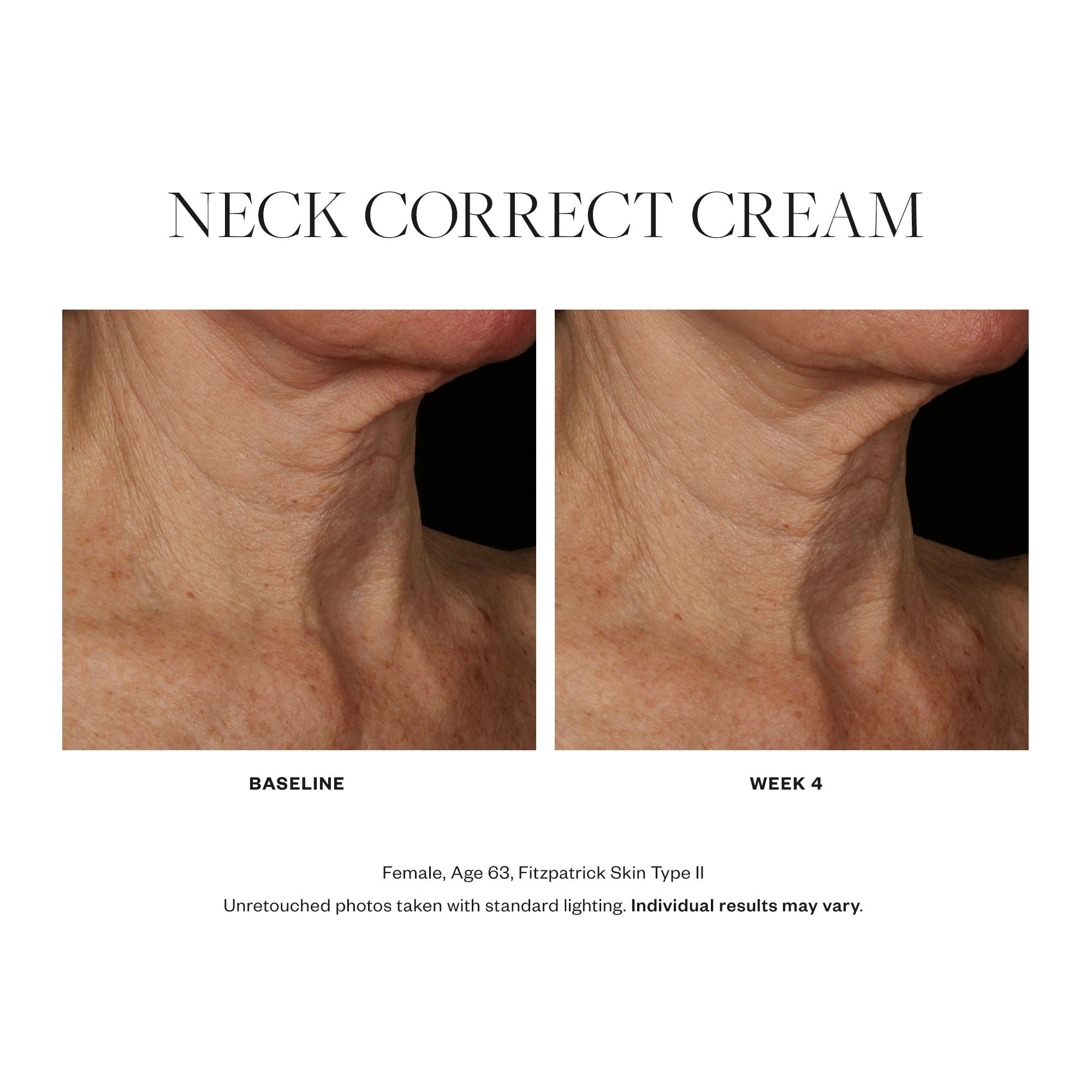 Neck Correct Cream