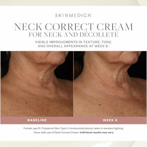 Neck Correct Cream