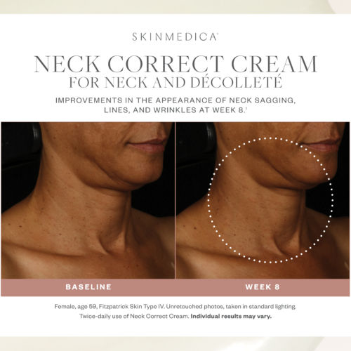 Neck Correct Cream