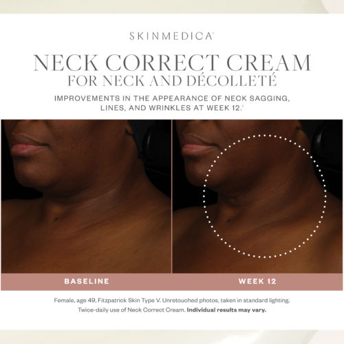 Neck Correct Cream