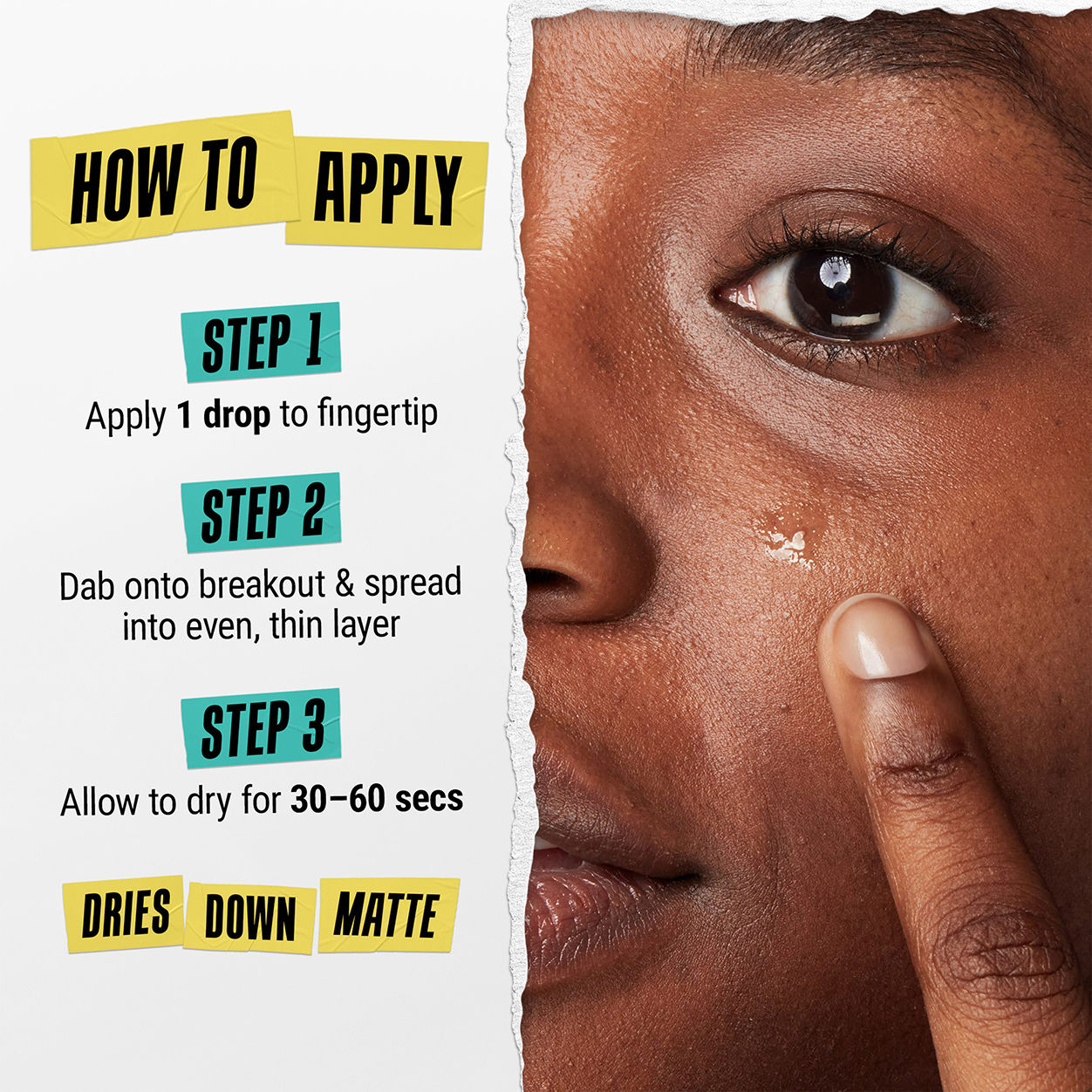 Truly Targeted Acne-Clearing Solution