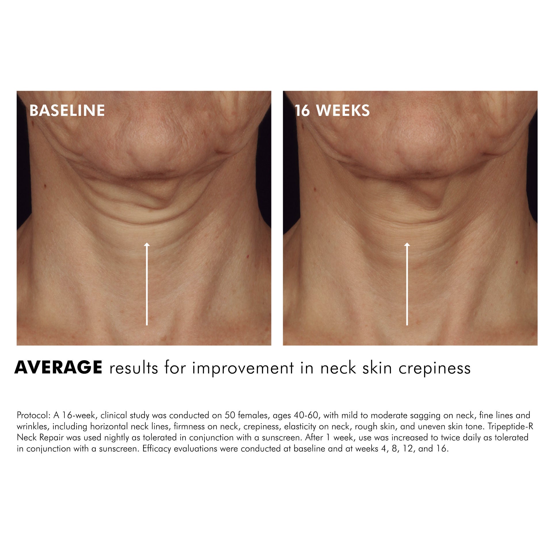 Tripeptide-R Neck Repair