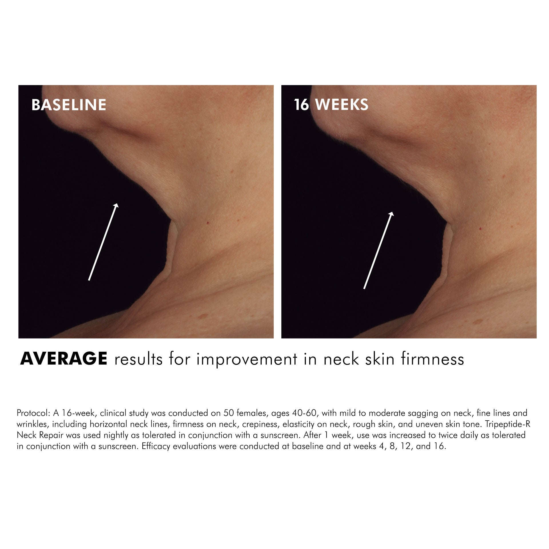 Tripeptide-R Neck Repair