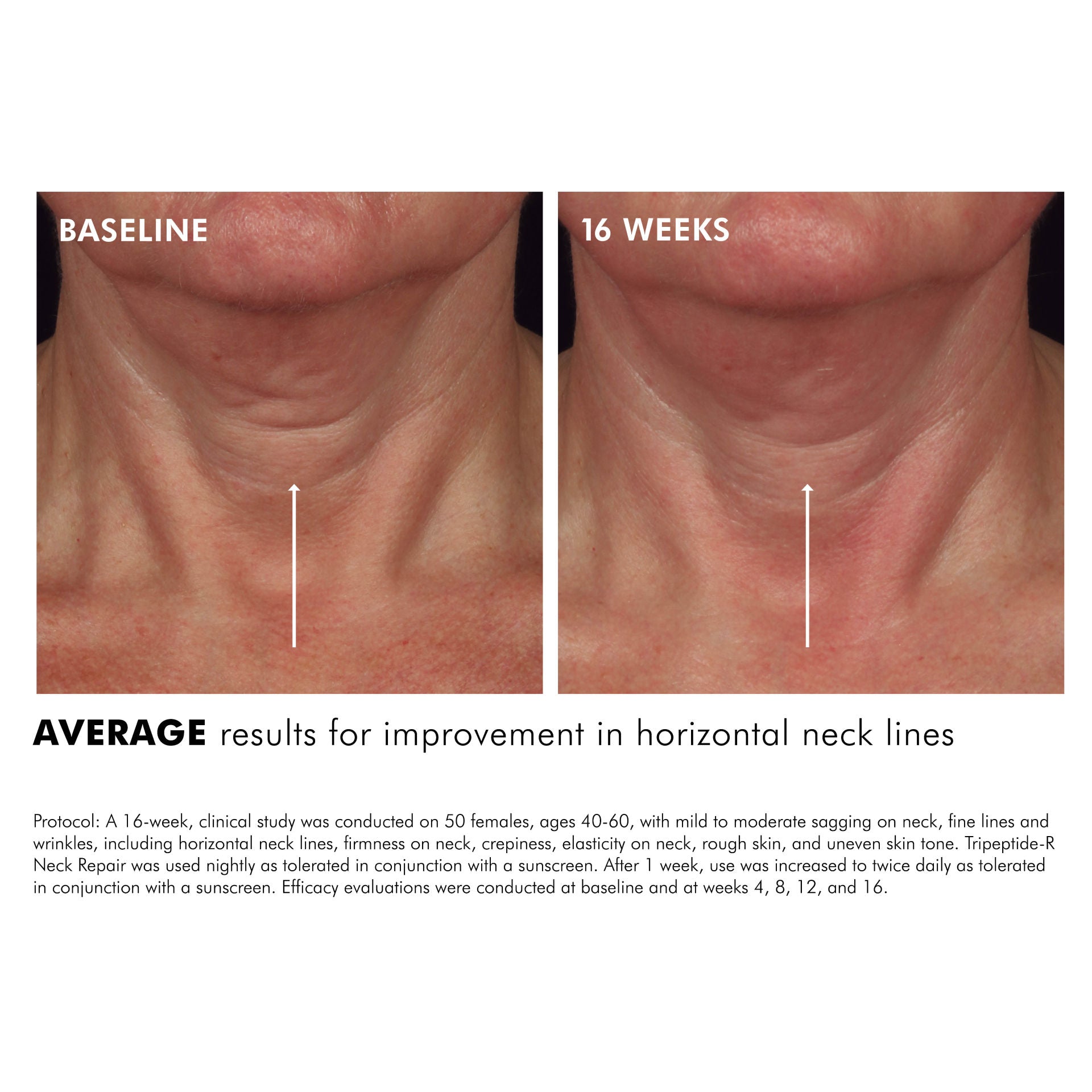 Tripeptide-R Neck Repair