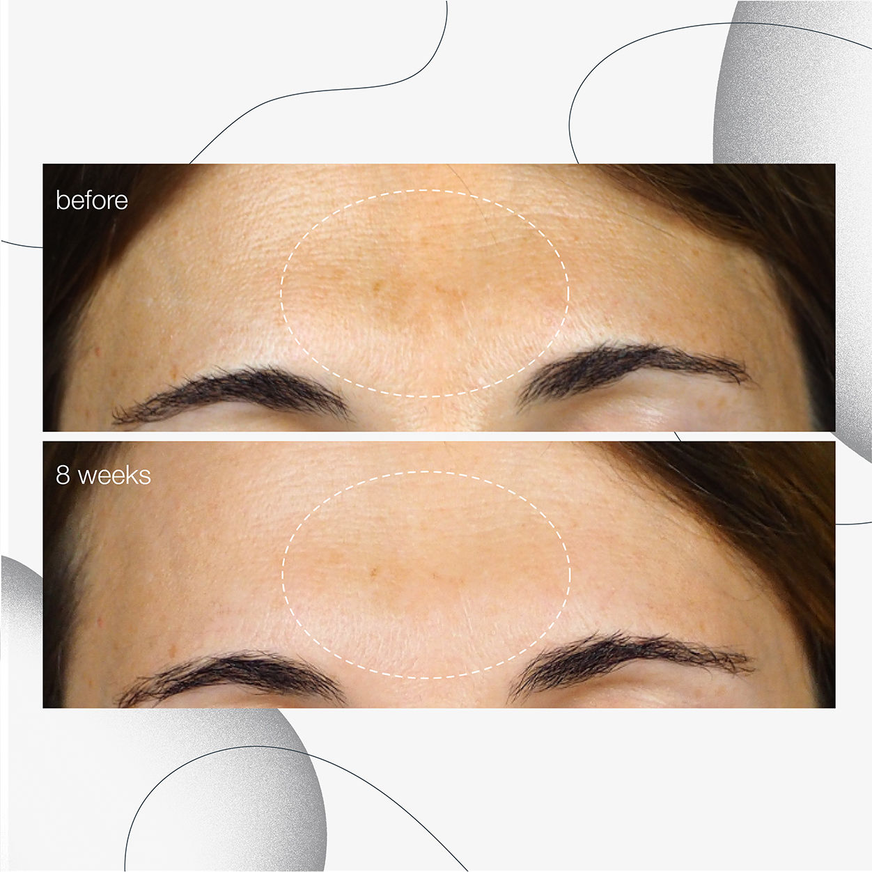 PowerBright Dark Spot Serum