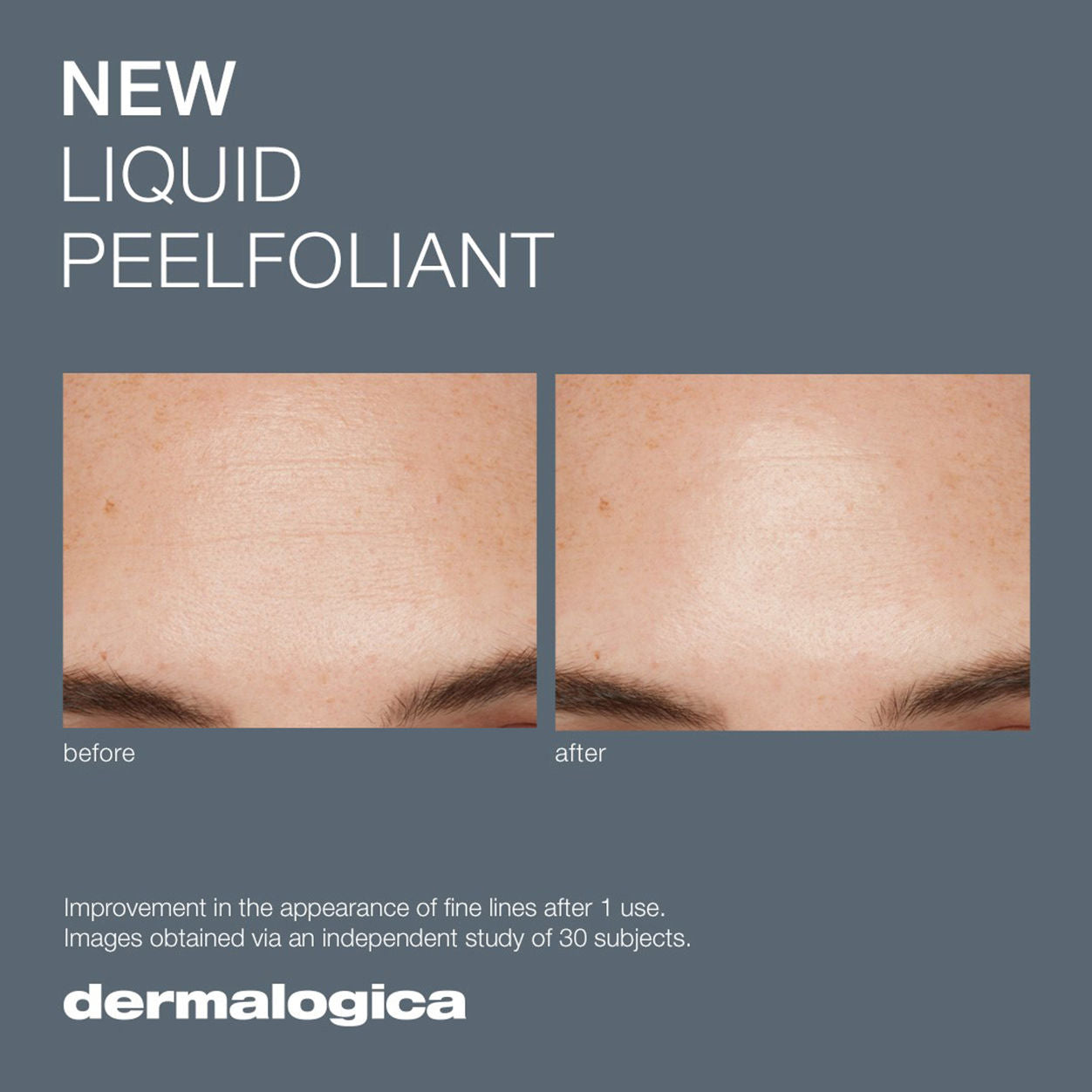 Liquid Peelfoliant