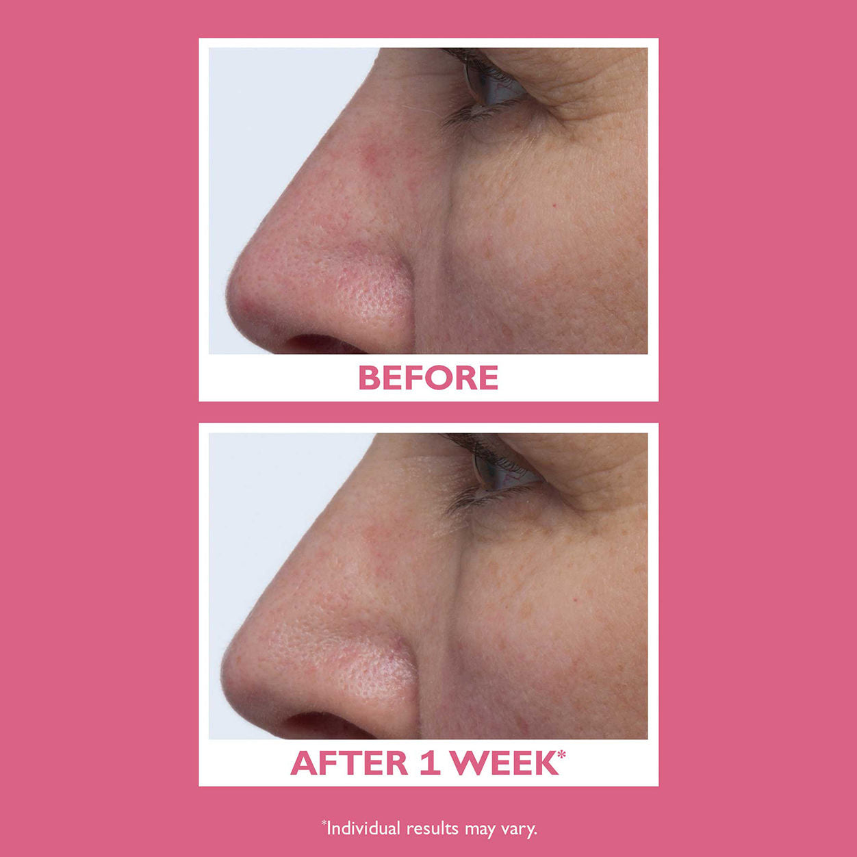 Vital-E Microbiome Age Defense Cream