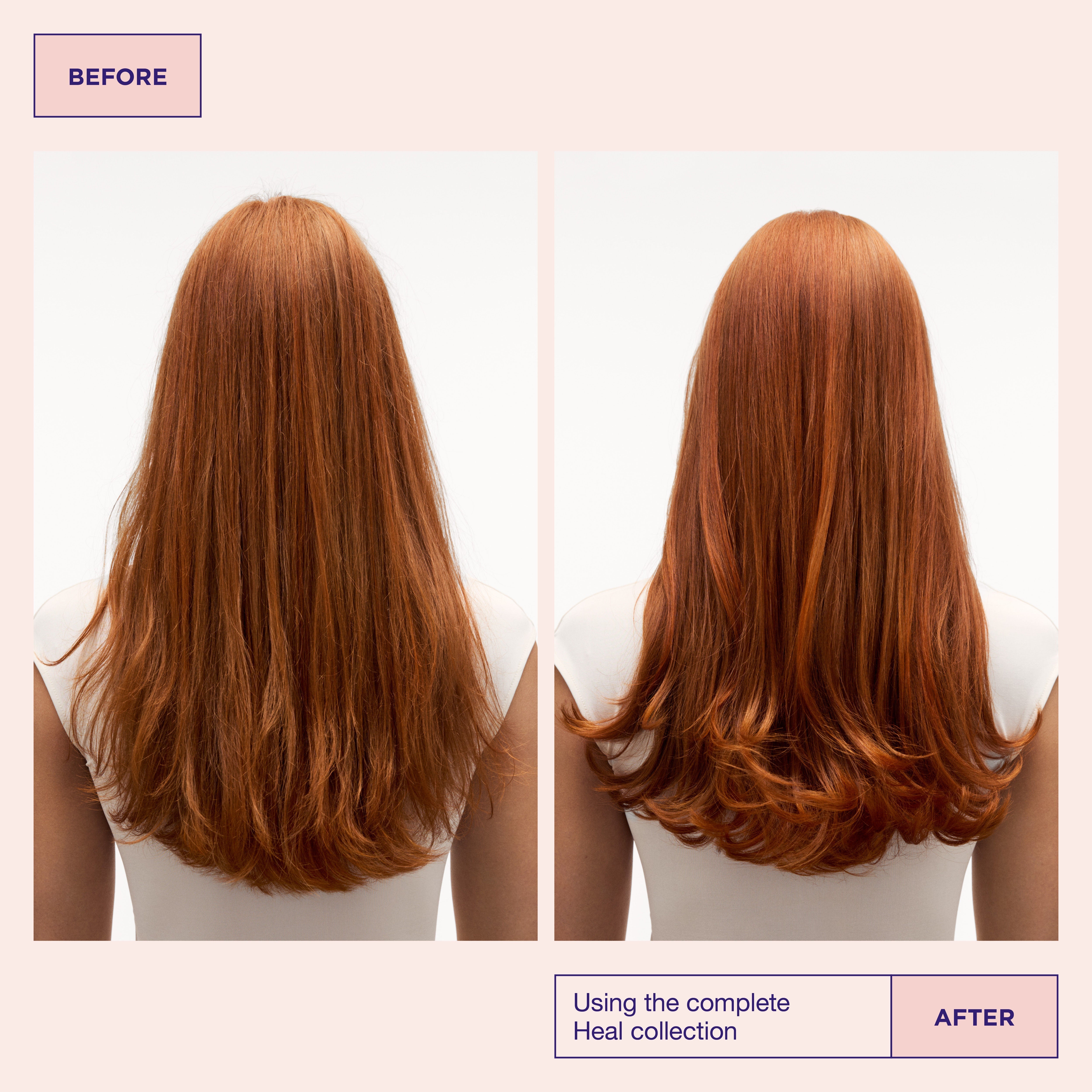 Head & Hair Heal Beauty Box (Limited Edition)