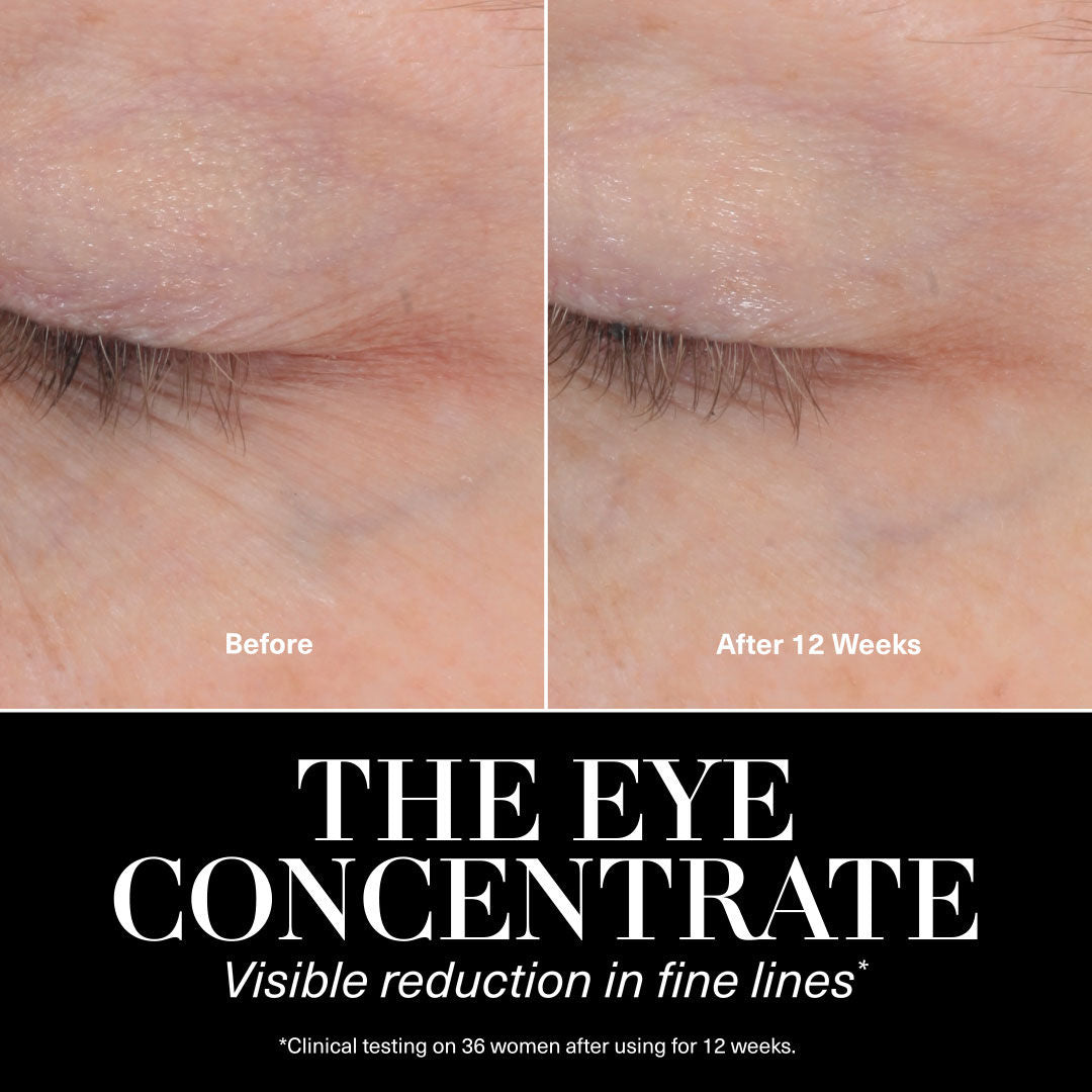 The Eye Concentrate