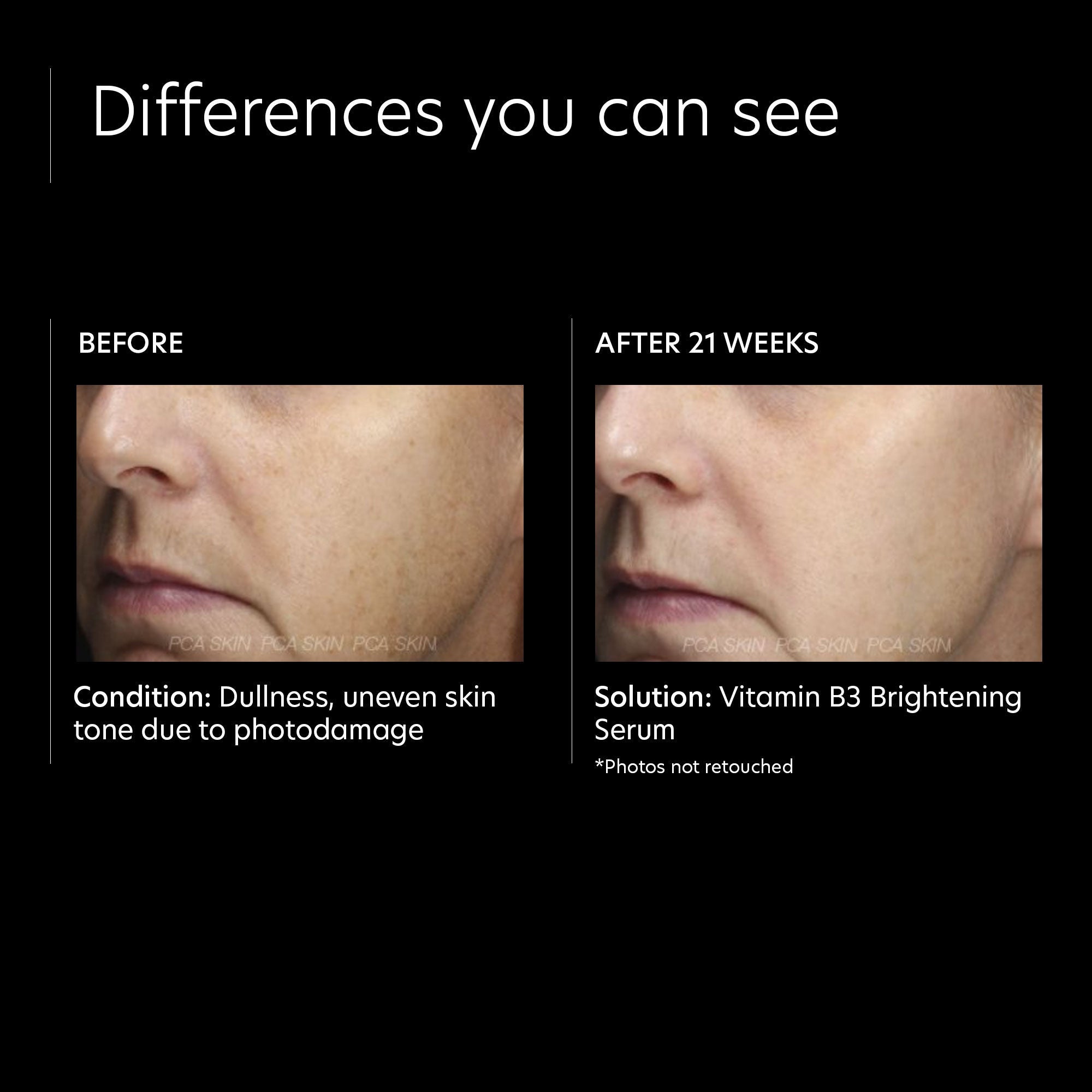 Vitamin B3 Brightening Serum