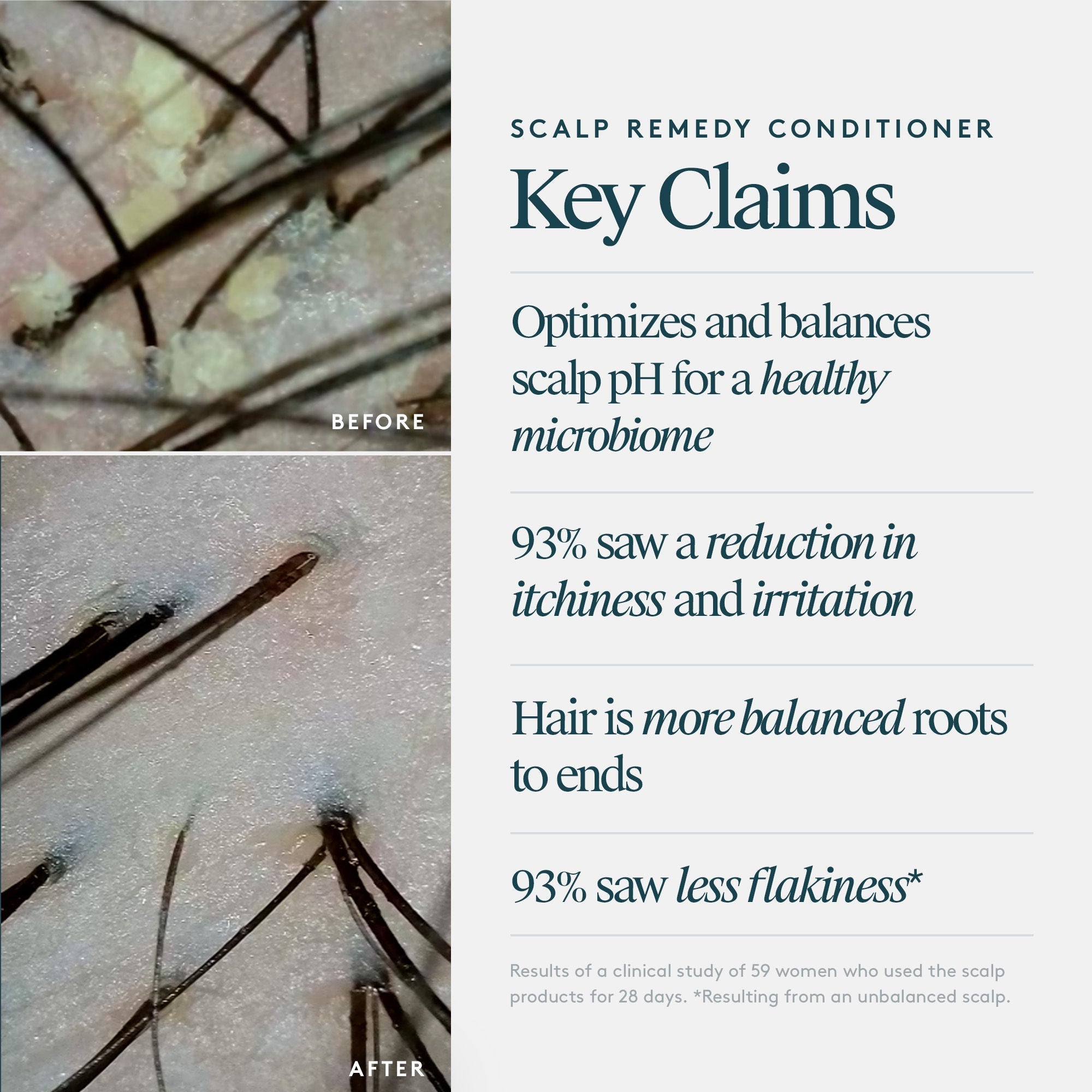 Scalp Remedy Conditioner for Scalp and Hair Health