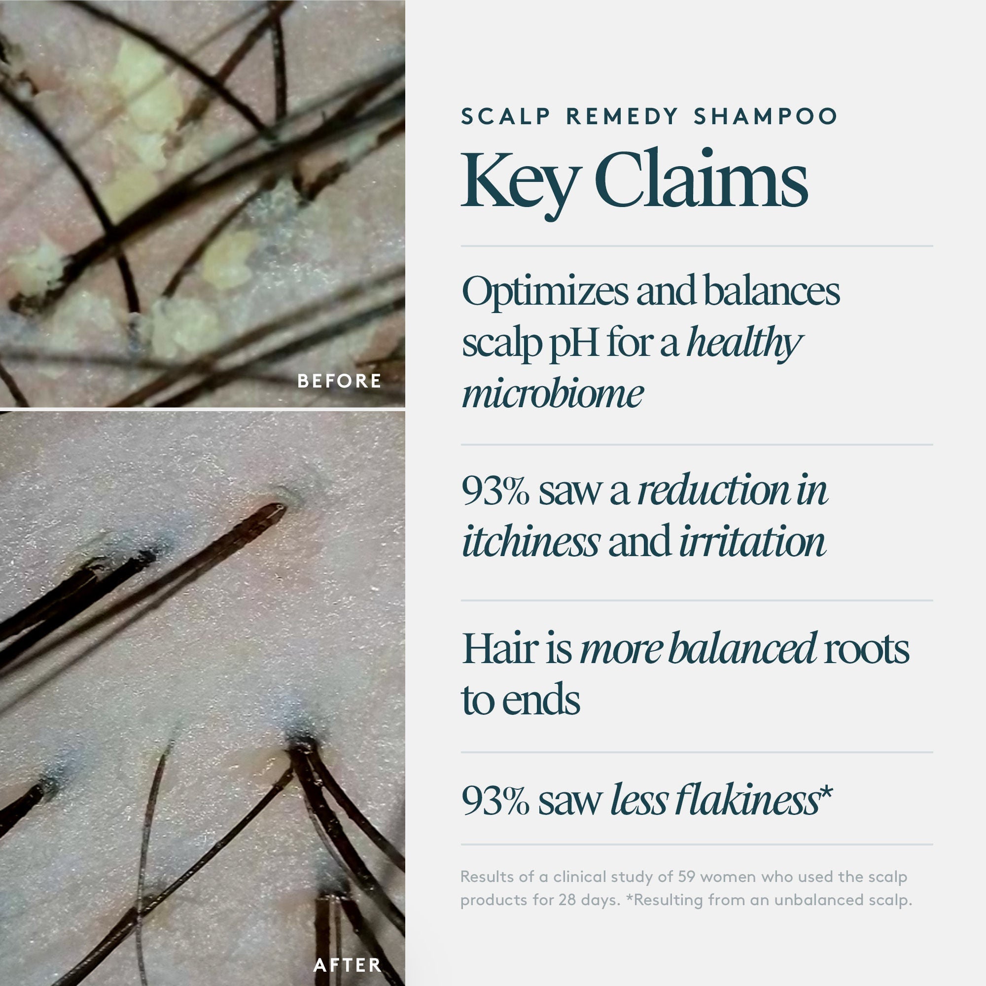 Scalp Remedy Shampoo for Scalp and Hair Health