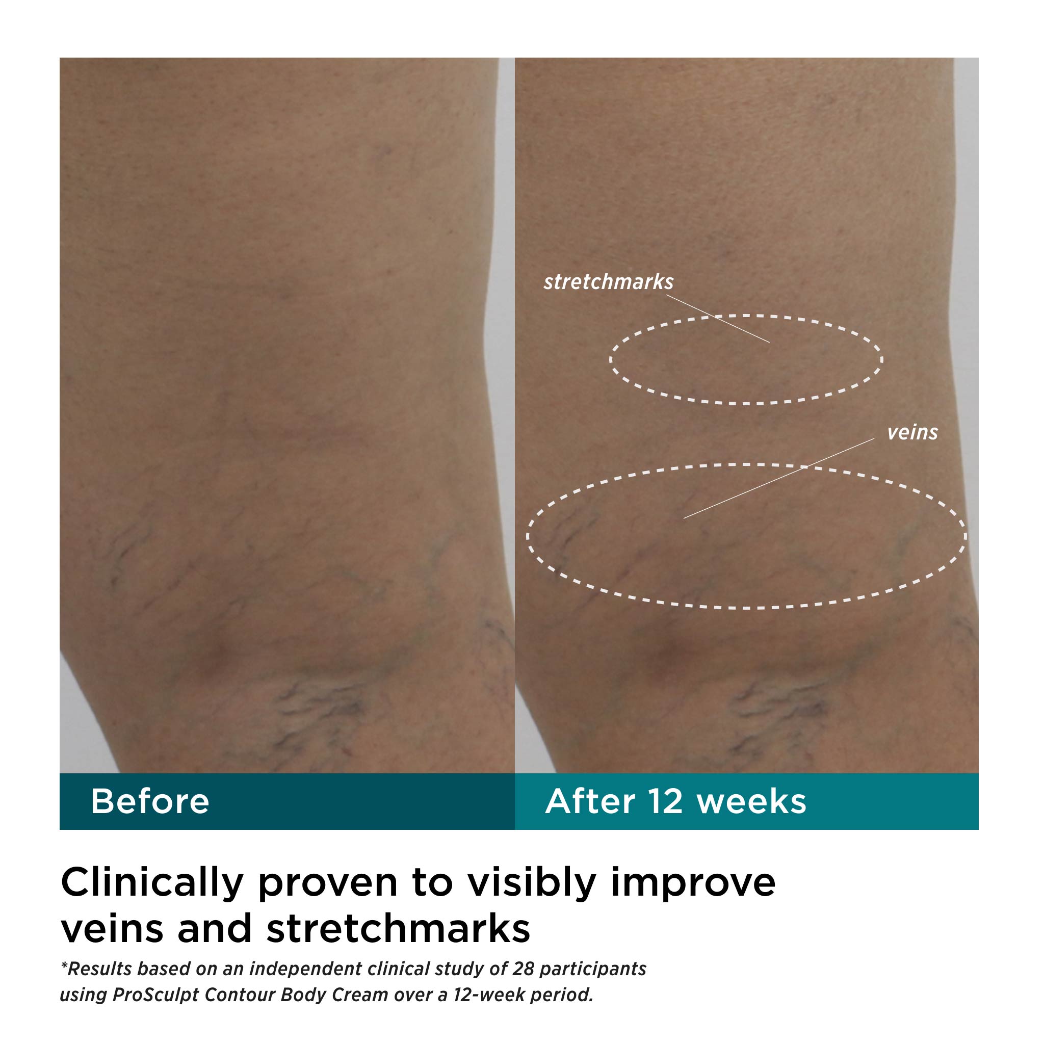 ProSculpt Contour Body Cream with AFT3™