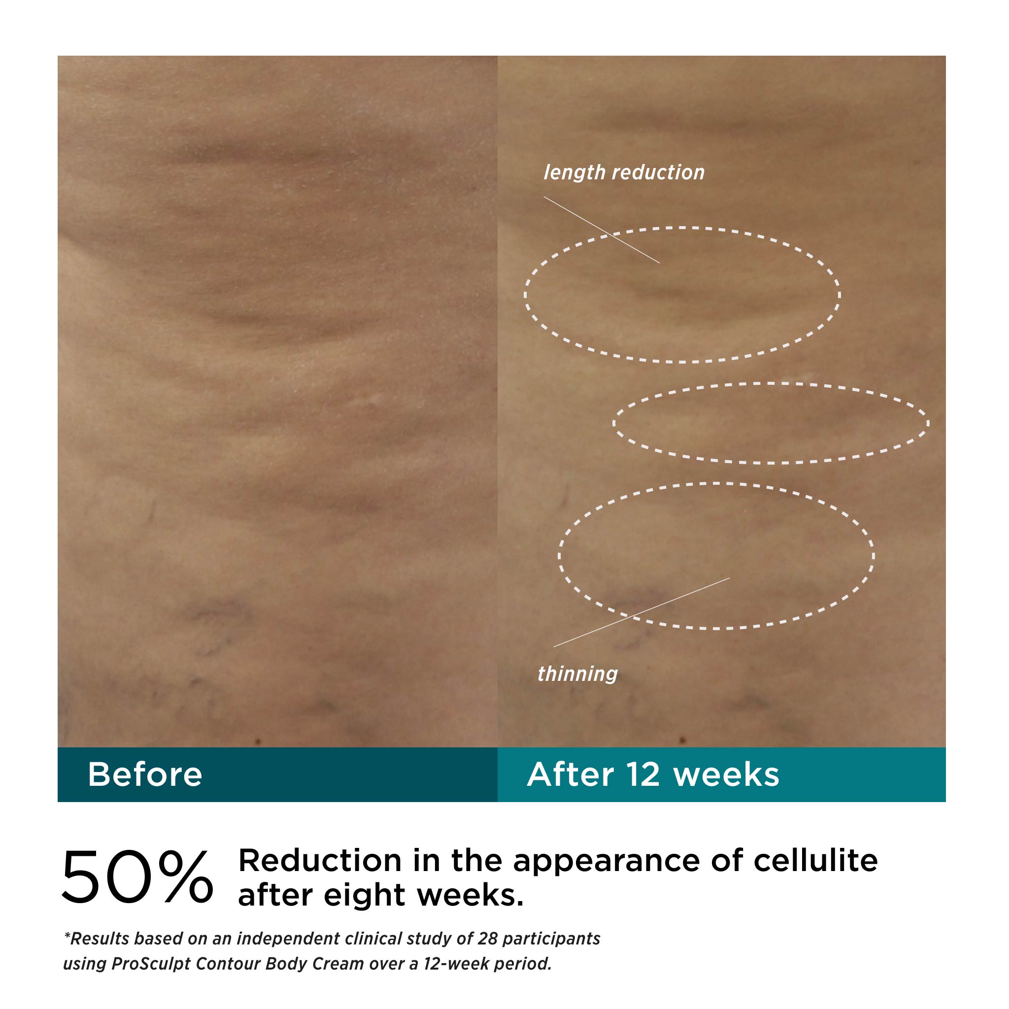 ProSculpt Contour Body Cream with AFT3™