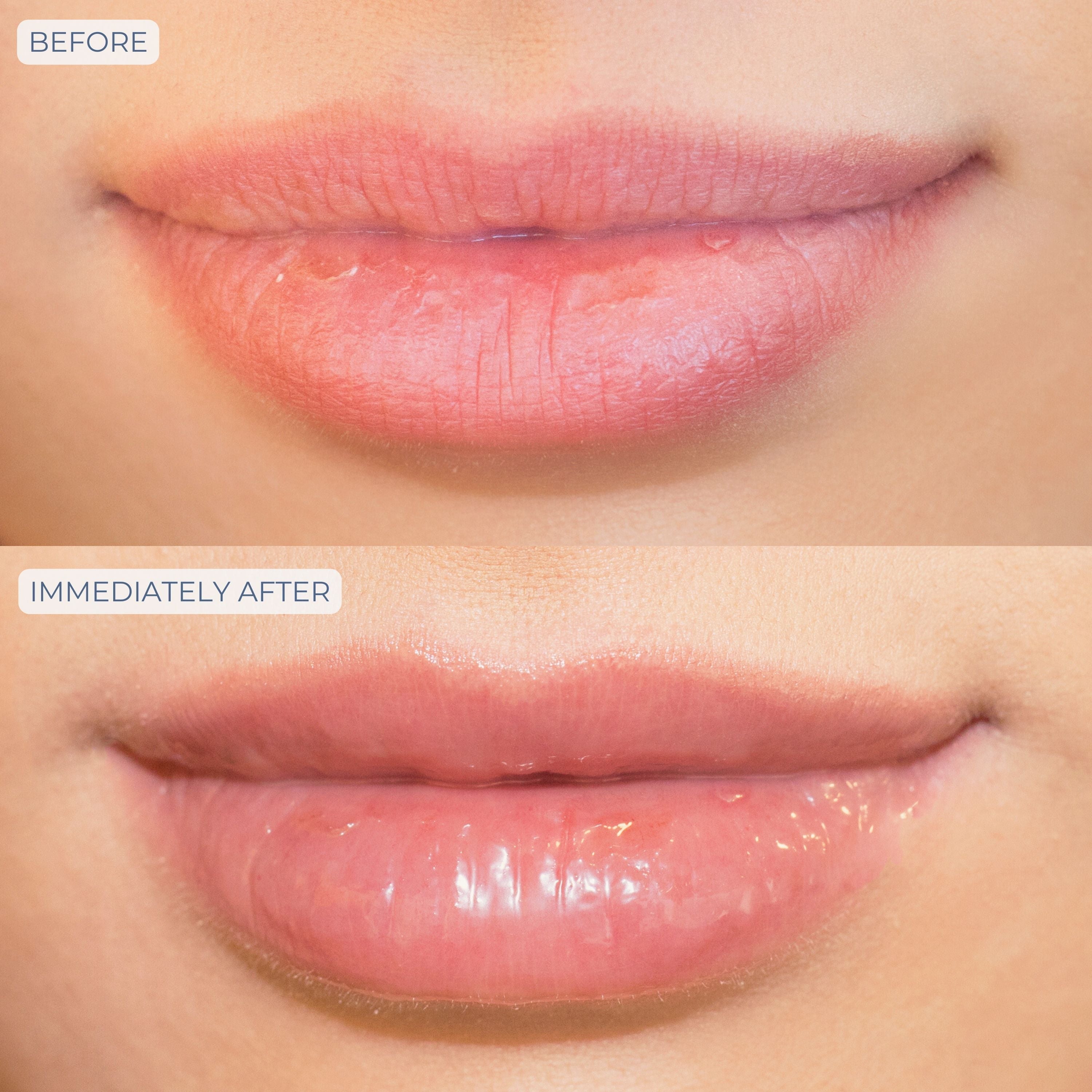 Tri-Liptide Peptide Lip Enhancing Treatment