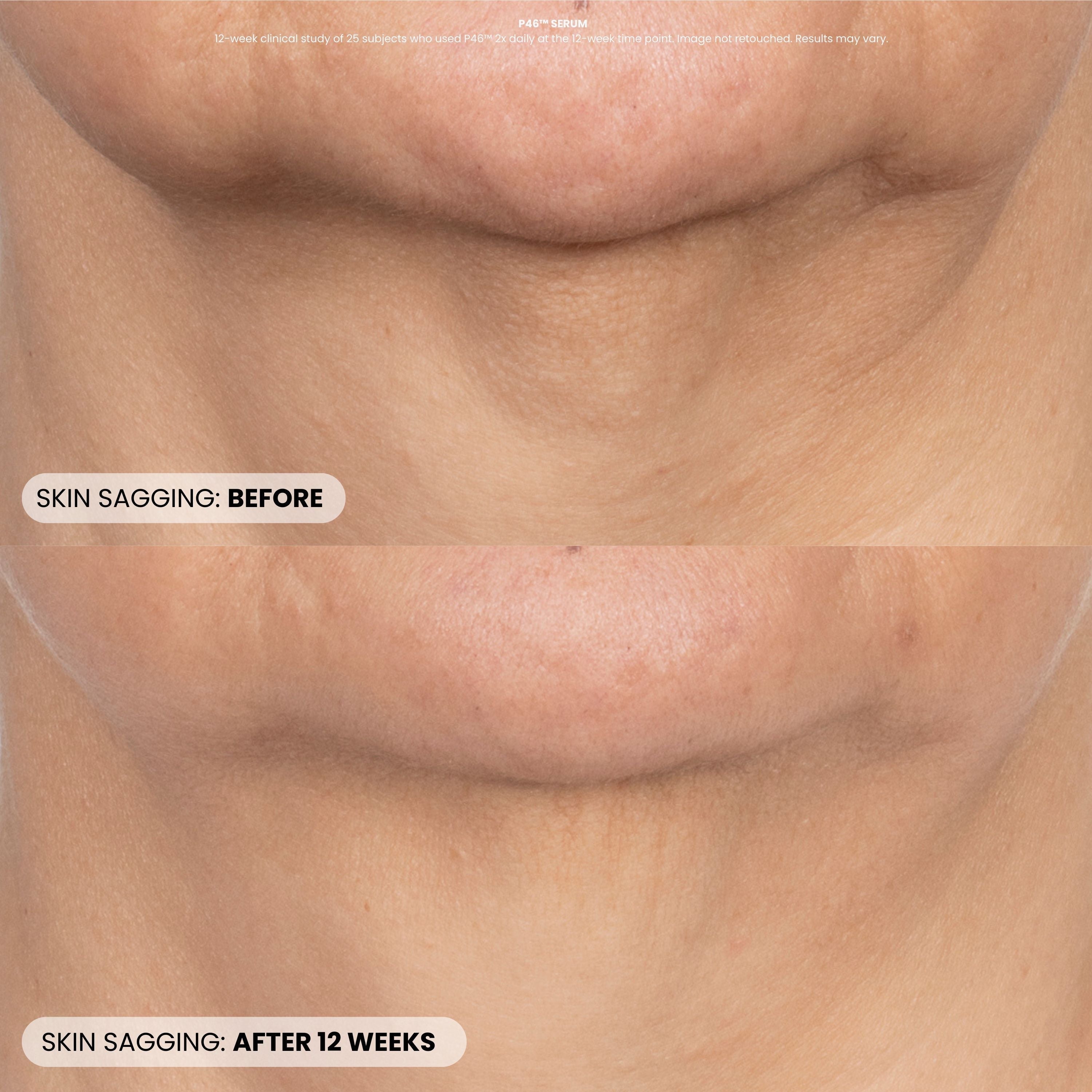 Procedure Enhancement Program