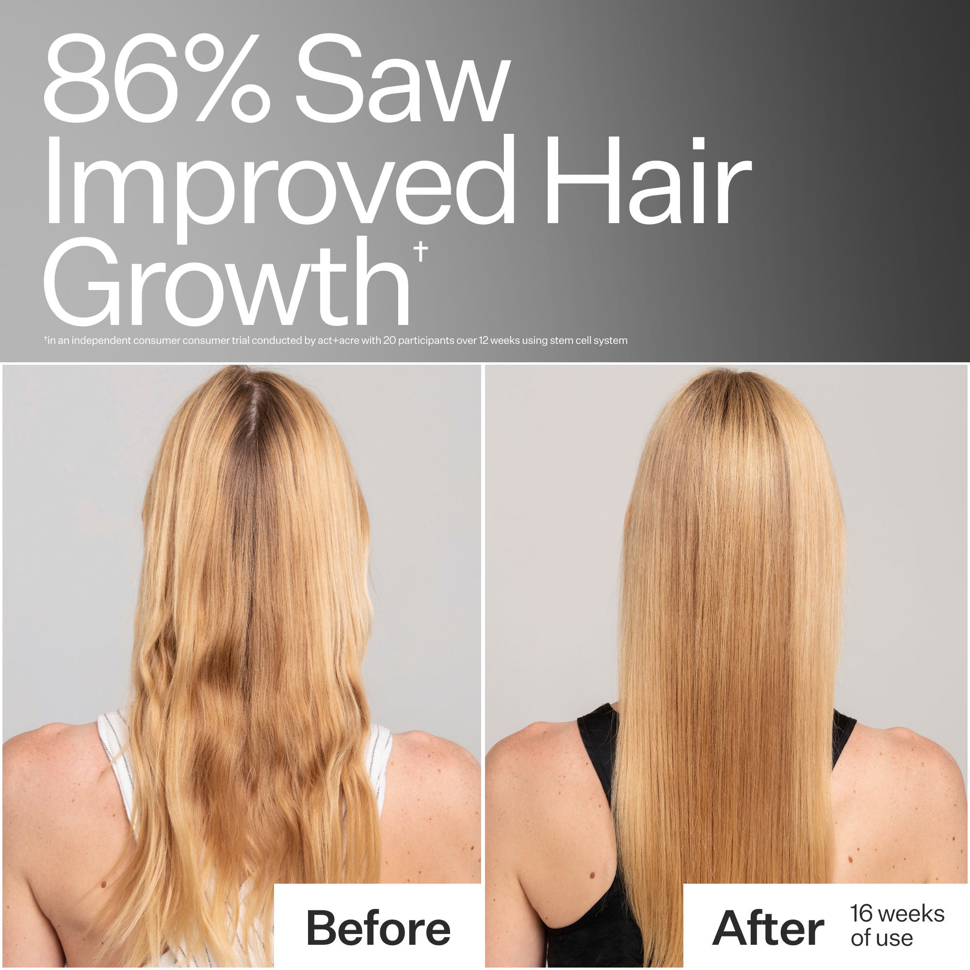 Stem Cell Shampoo For Thicker Fuller-Looking Hair