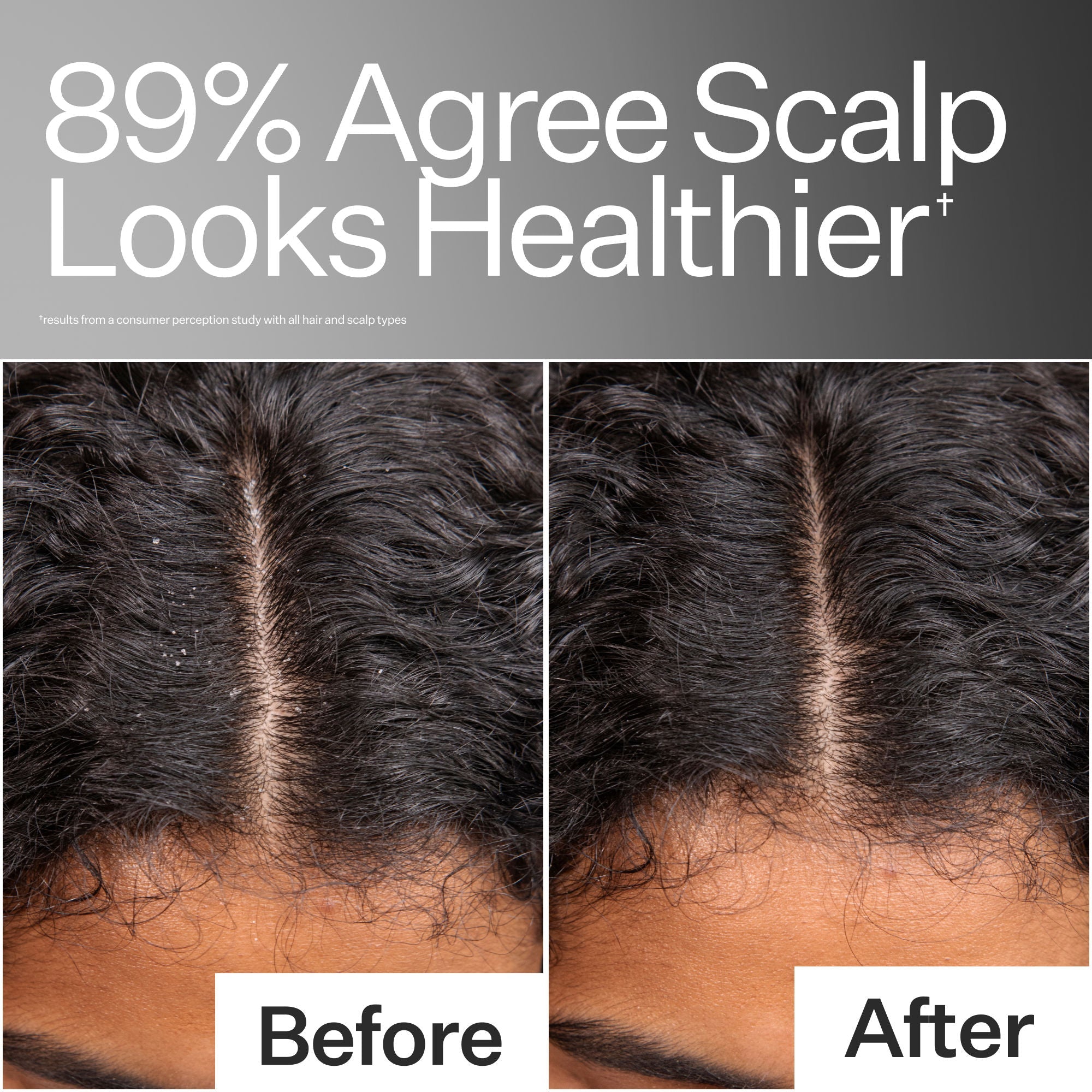 Scalp Relief System