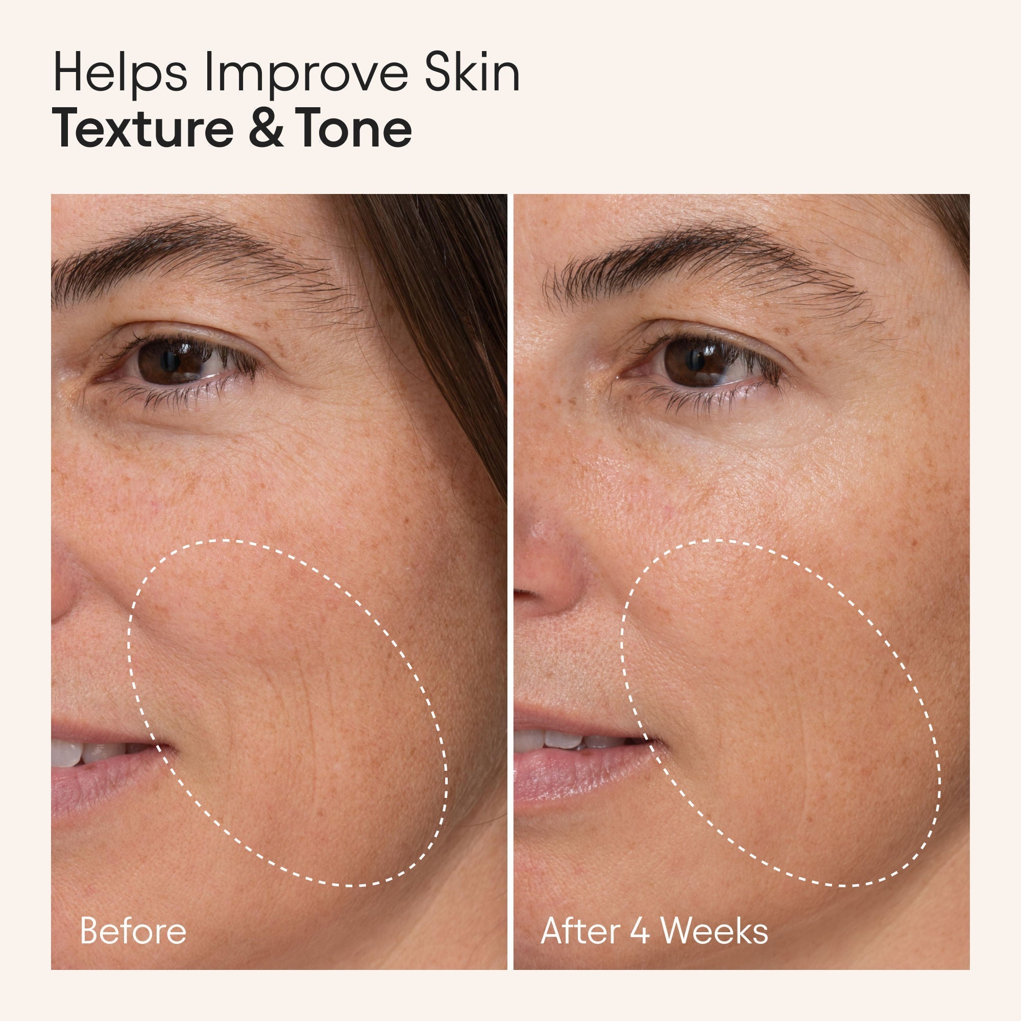 Hydrating Firming Serum with Niacinamide and Nettle