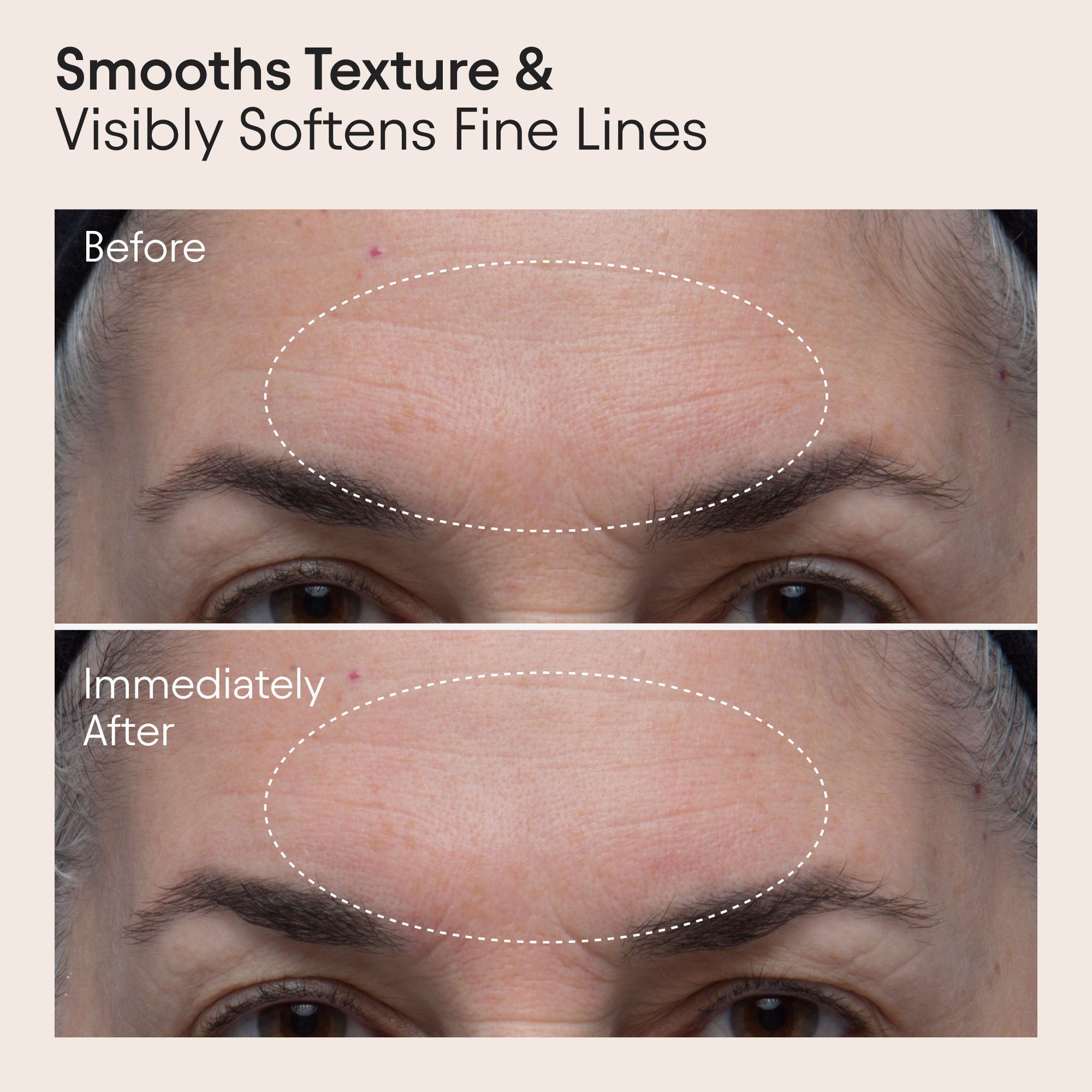 Polishing Peel and Brightening Face Mask with 8 Acids and Huckleberry