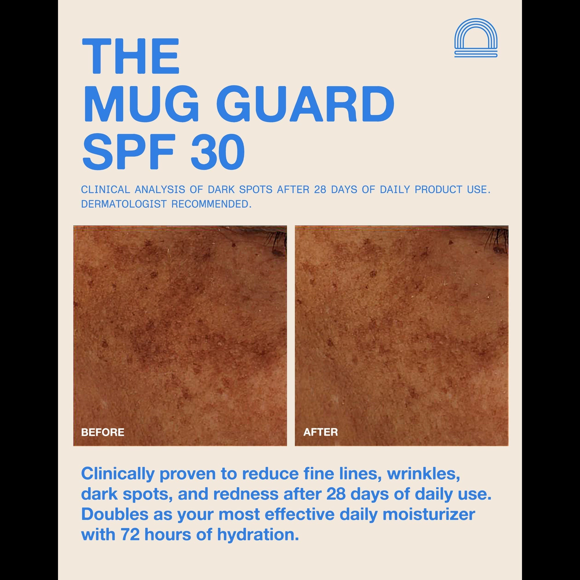 The Mug Guard SPF 30