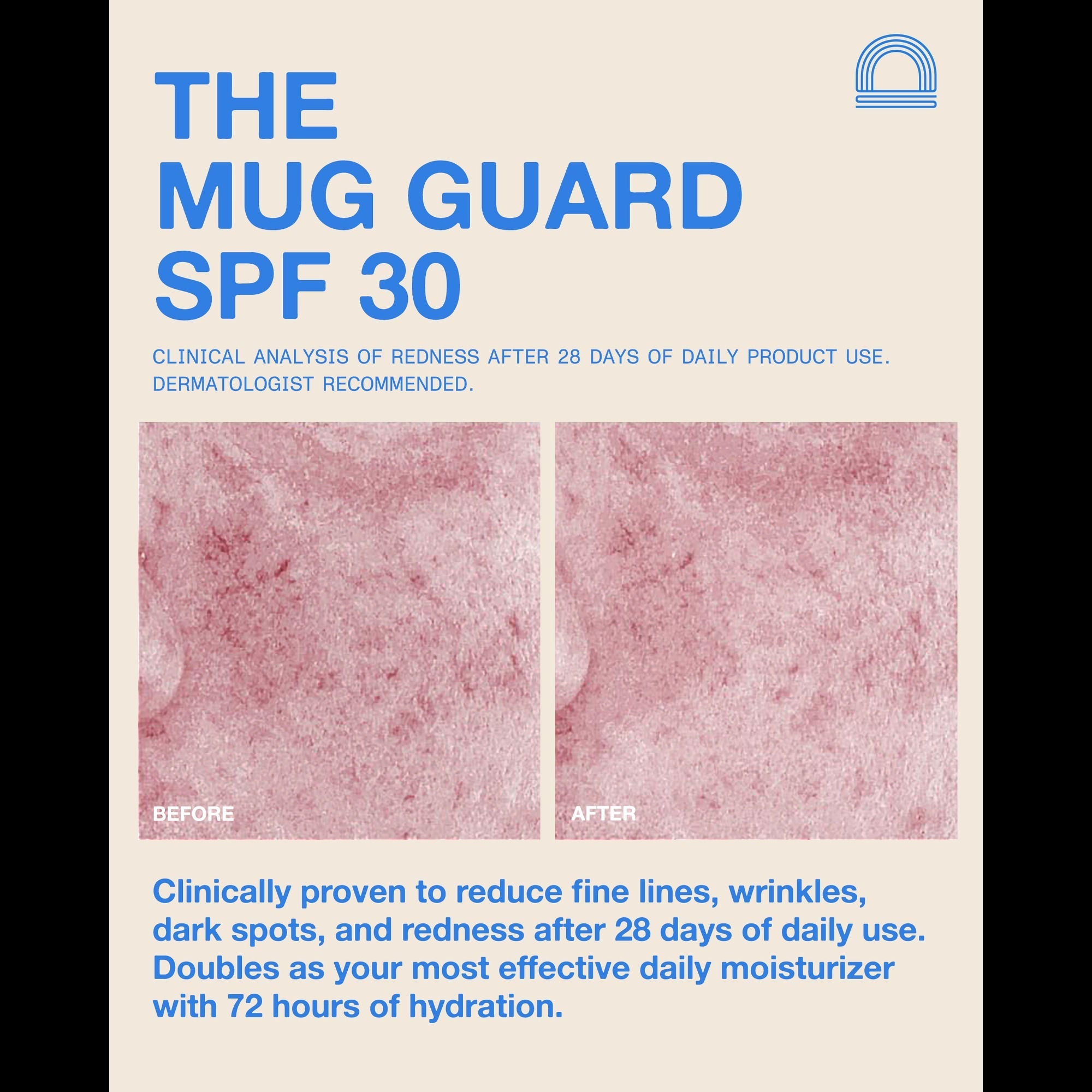 The Mug Guard SPF 30
