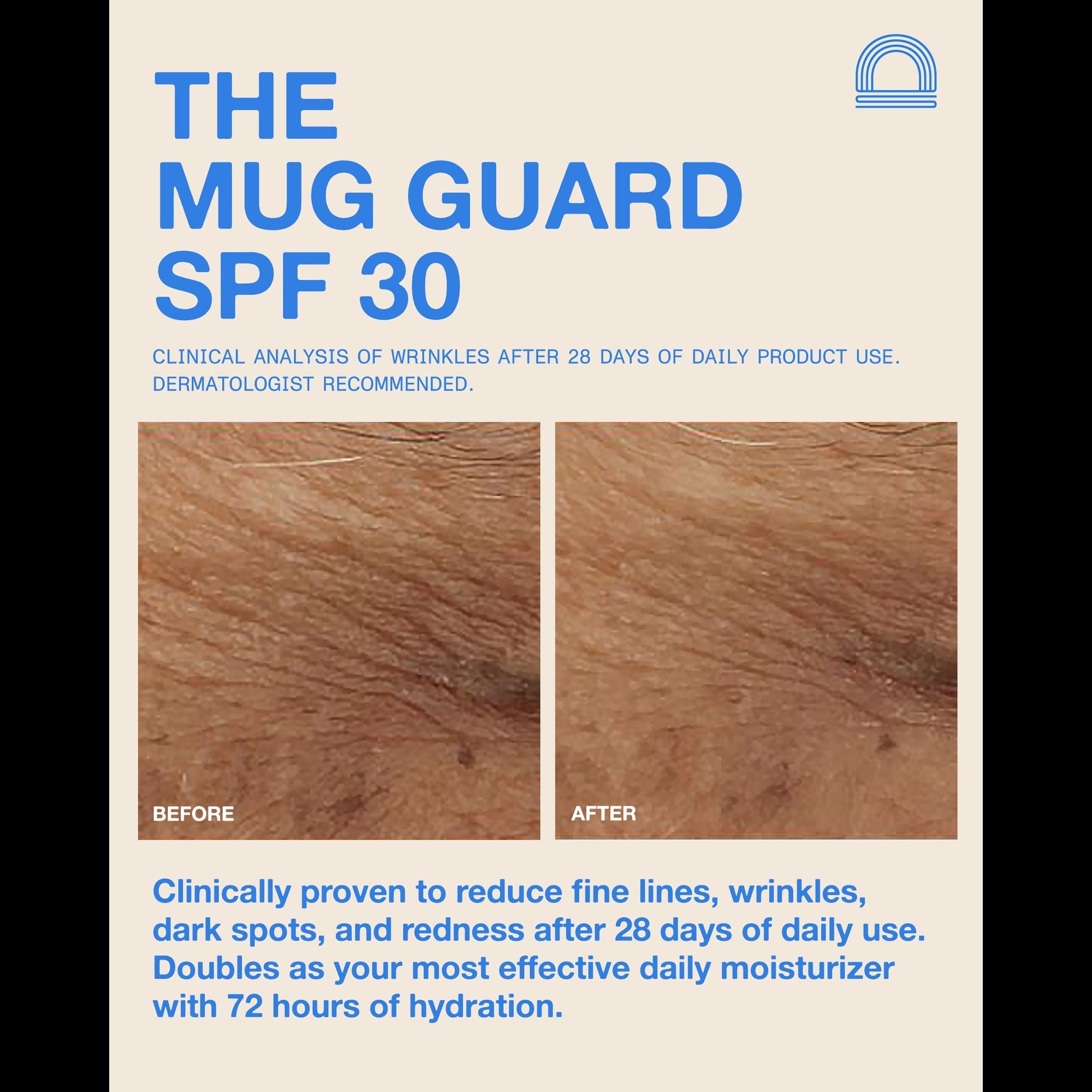 The Mug Guard SPF 30