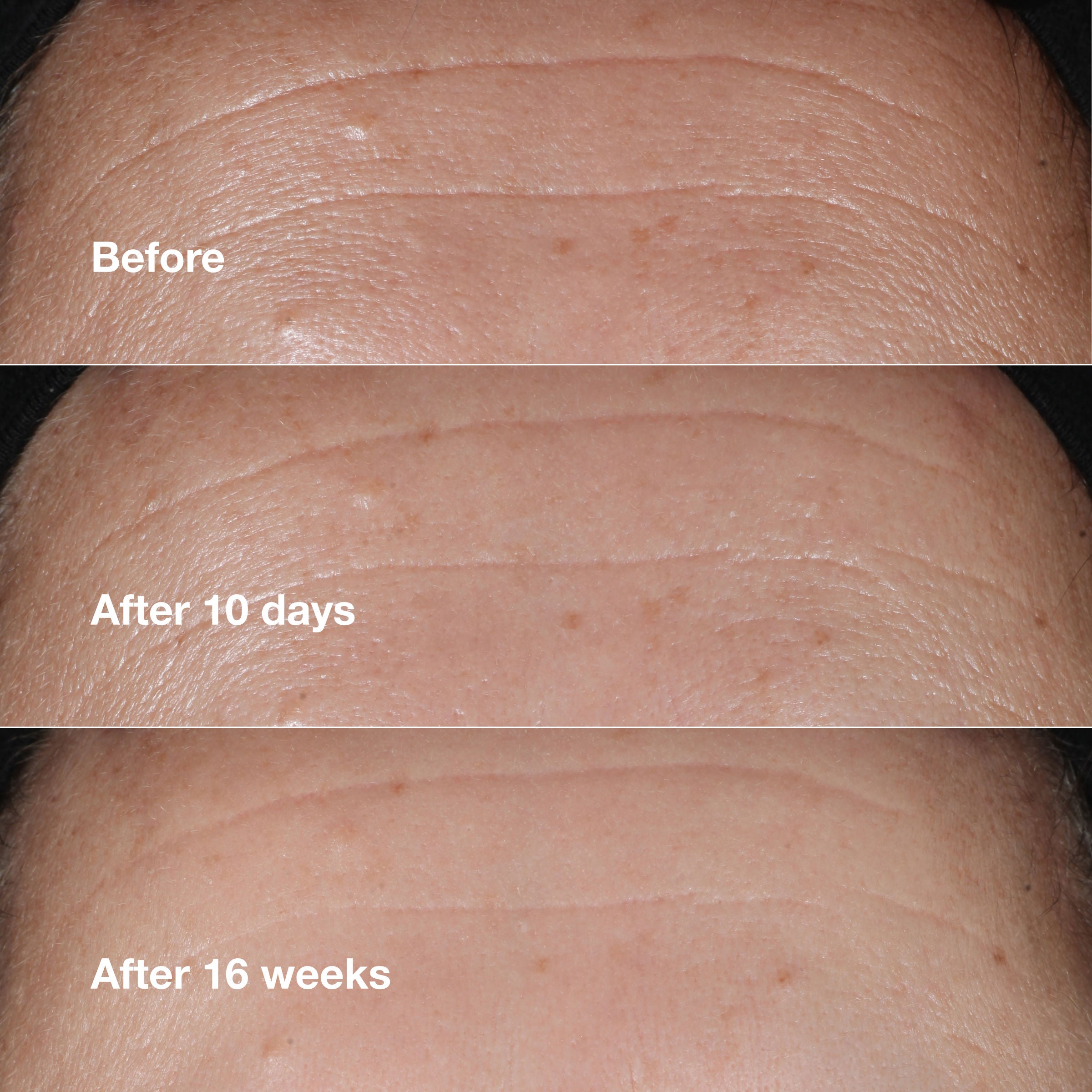 Smart Clinical Repair Wrinkle Correcting Serum