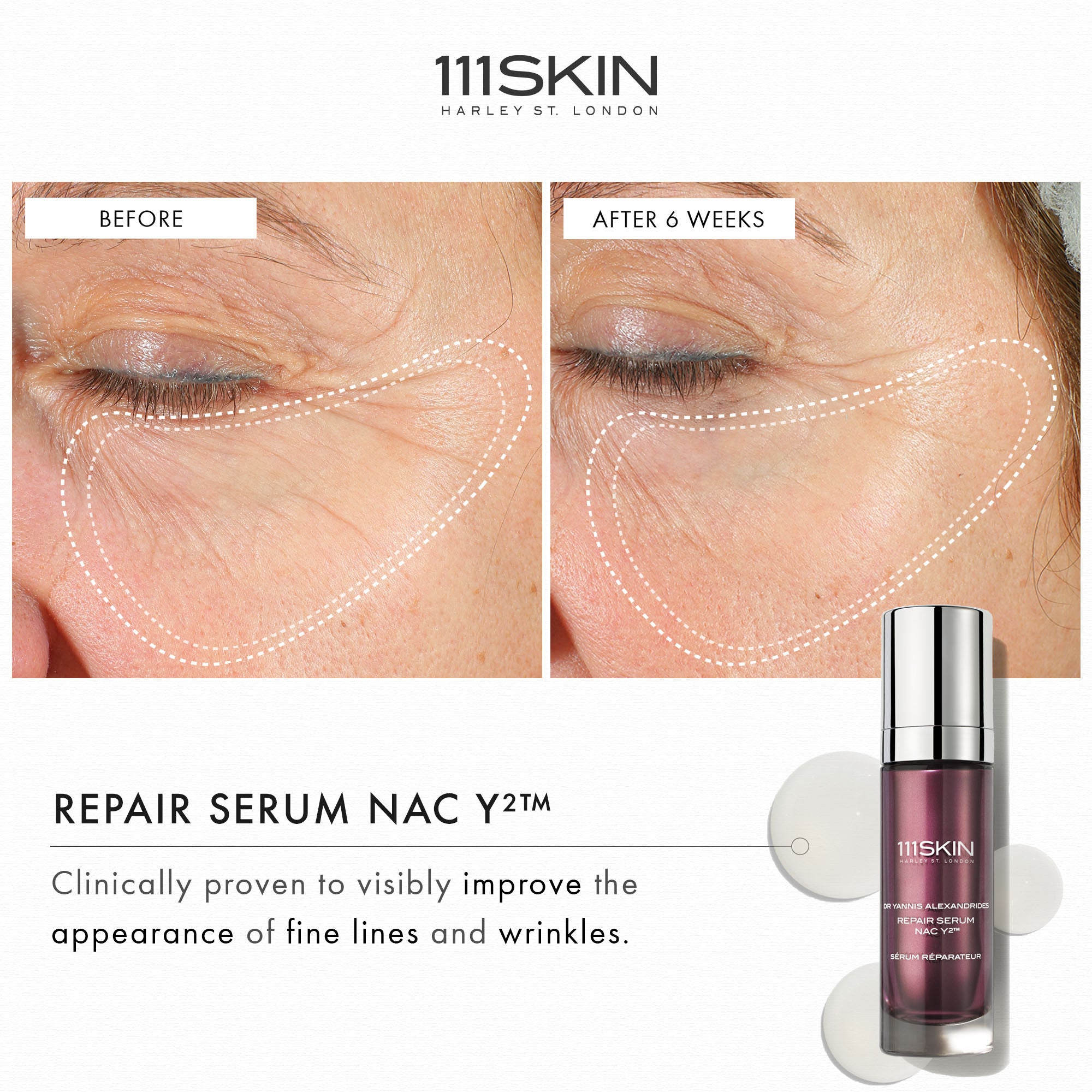 Repair Serum NAC Y2