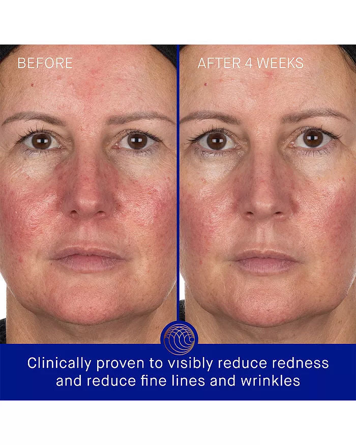 The Hydrogel Face Mask