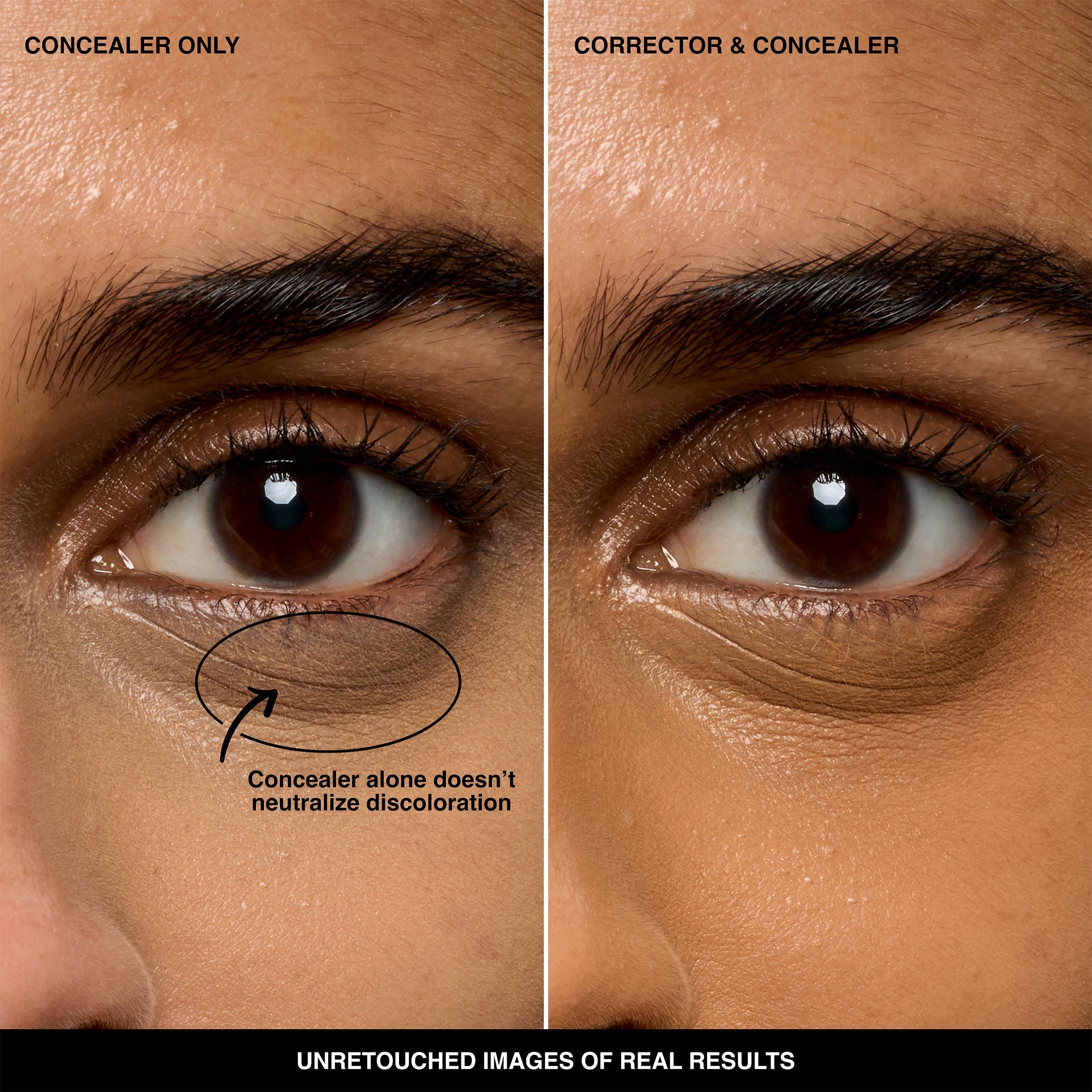 Skin Corrector Stick