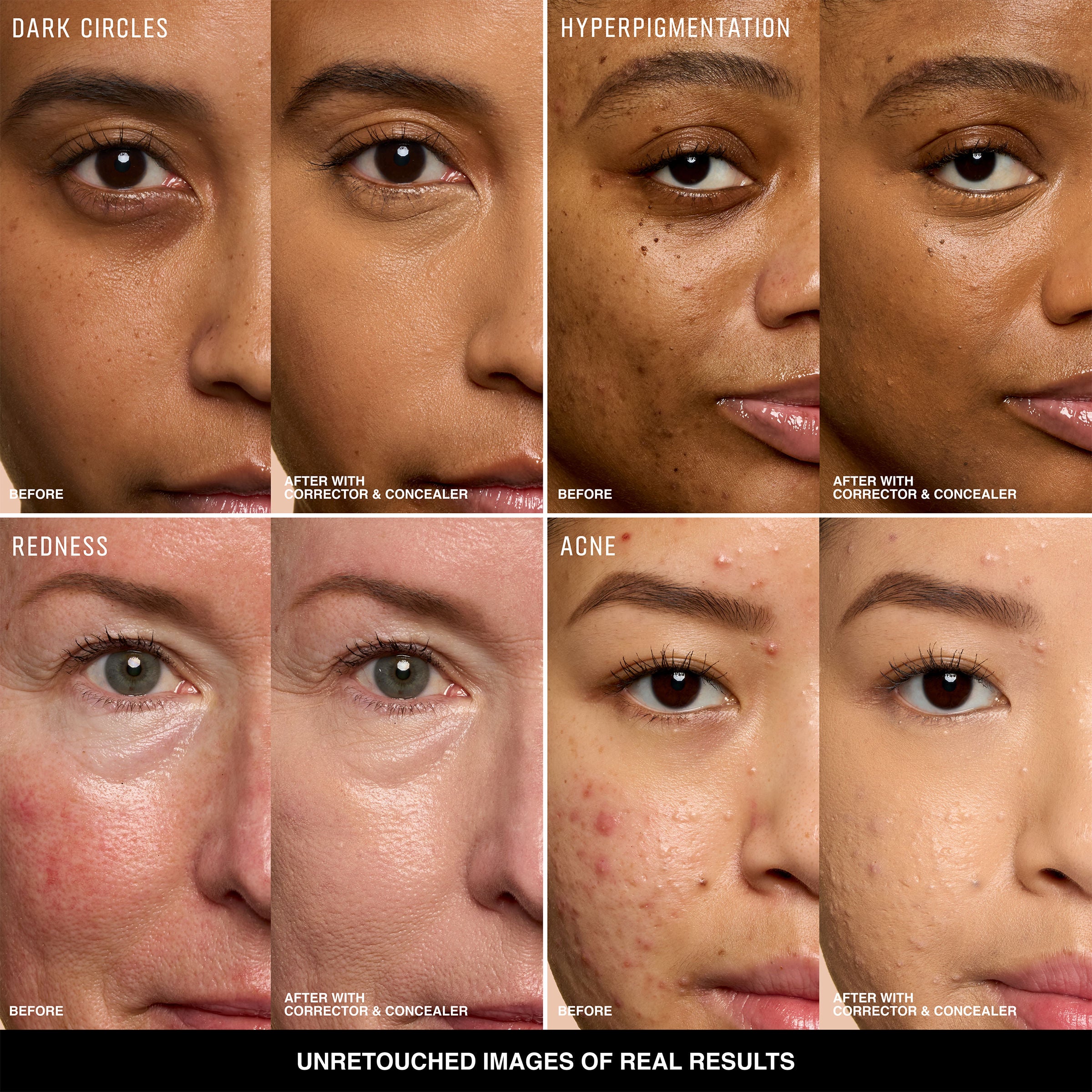 Skin Corrector Stick