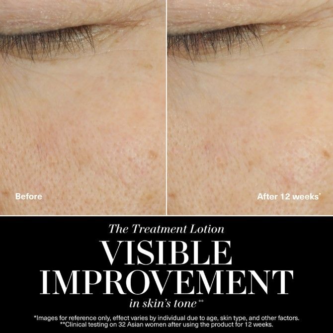 The Treatment Lotion