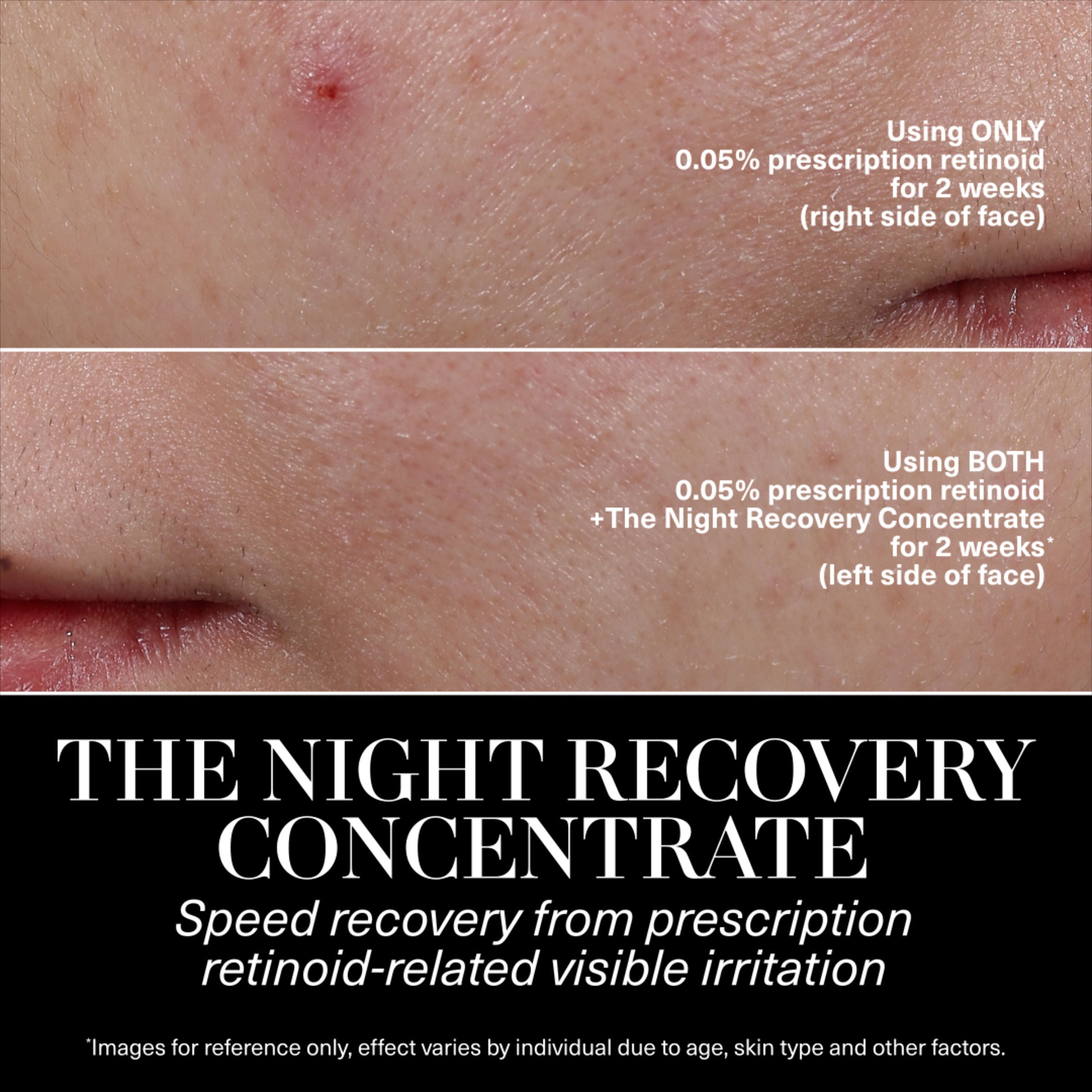 The Night Recovery Concentrate Treatment