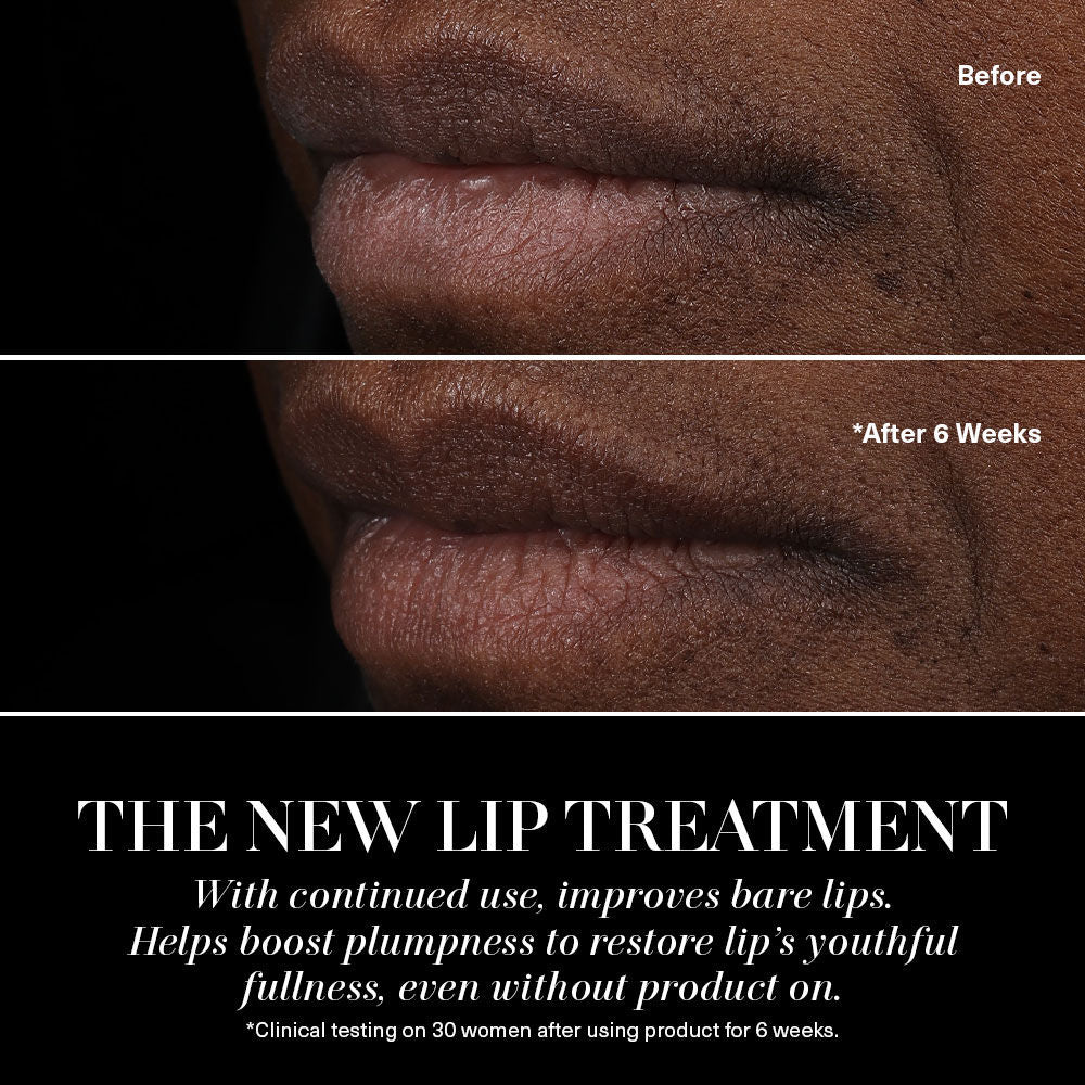 The Lip Treatment
