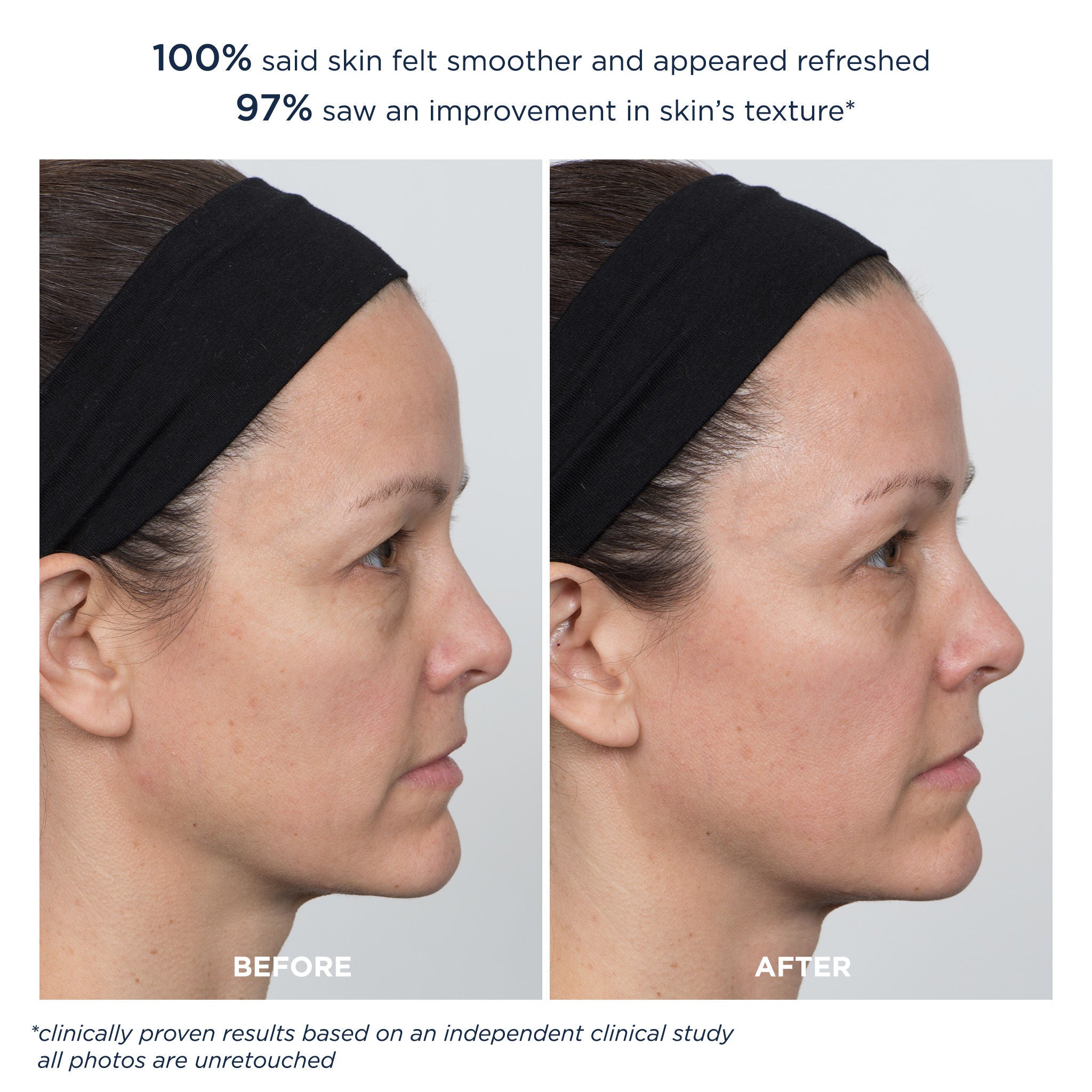 PowerGlow Peel Extra Strength