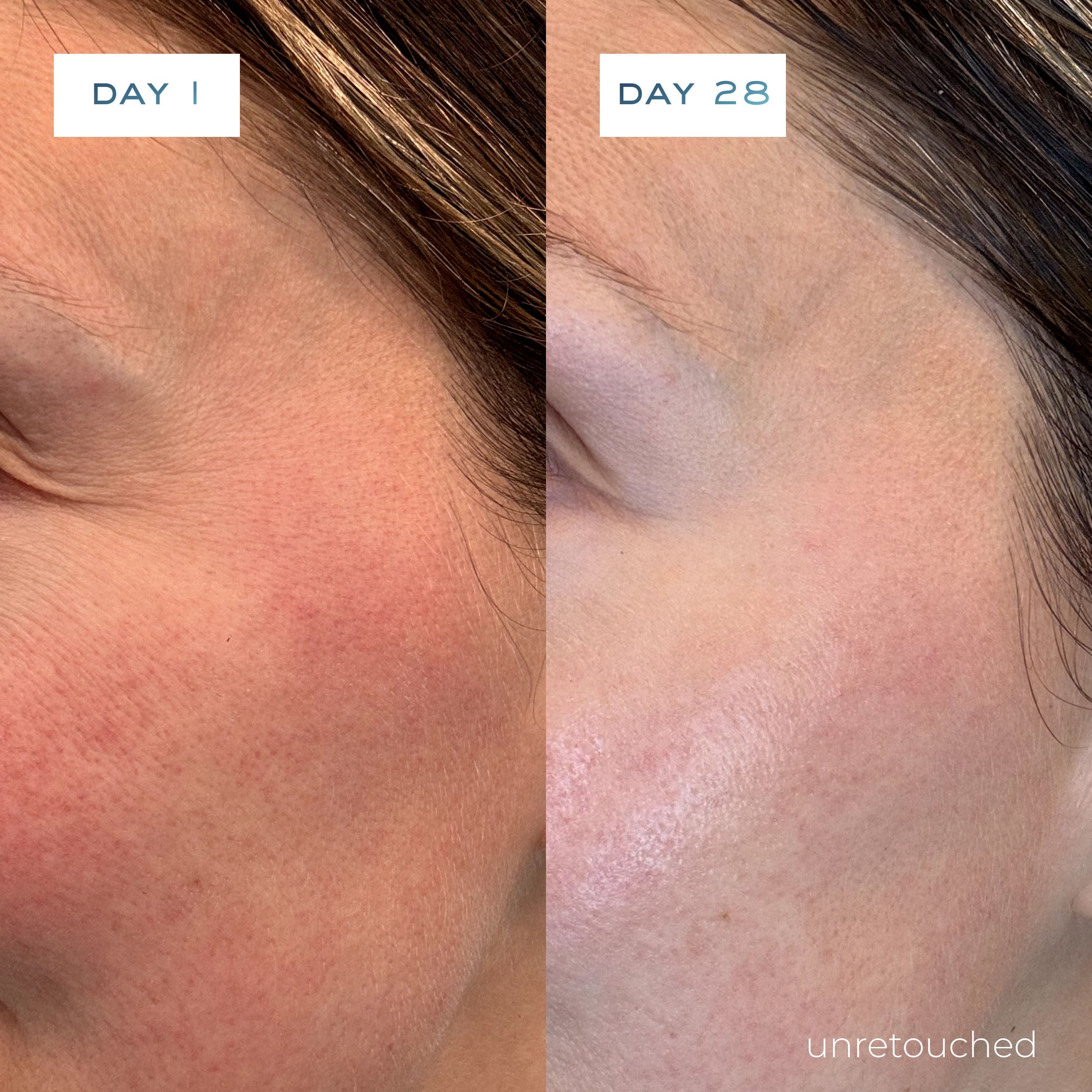 O2 Niacinamide Eight Active Serum