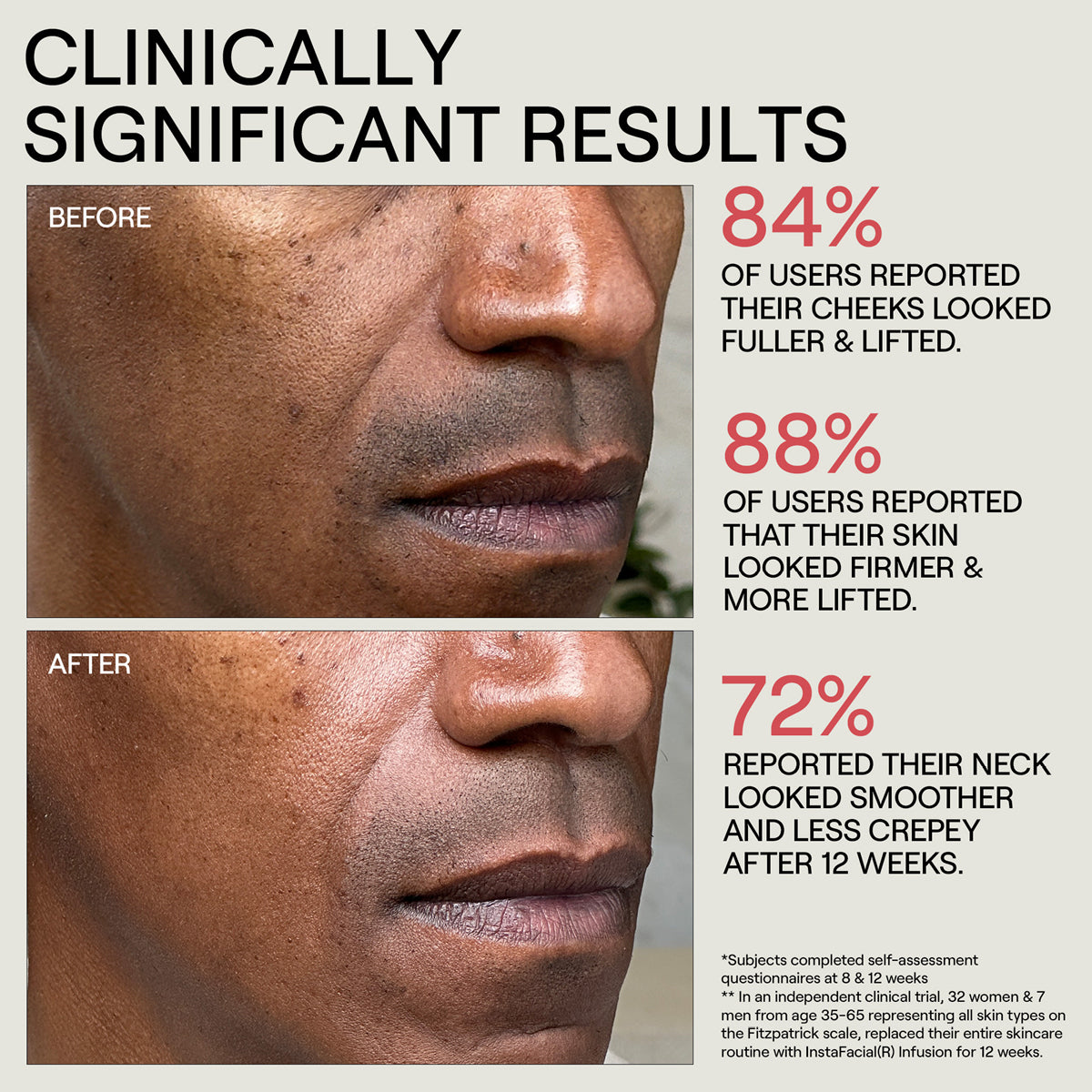 Instafacial Collection