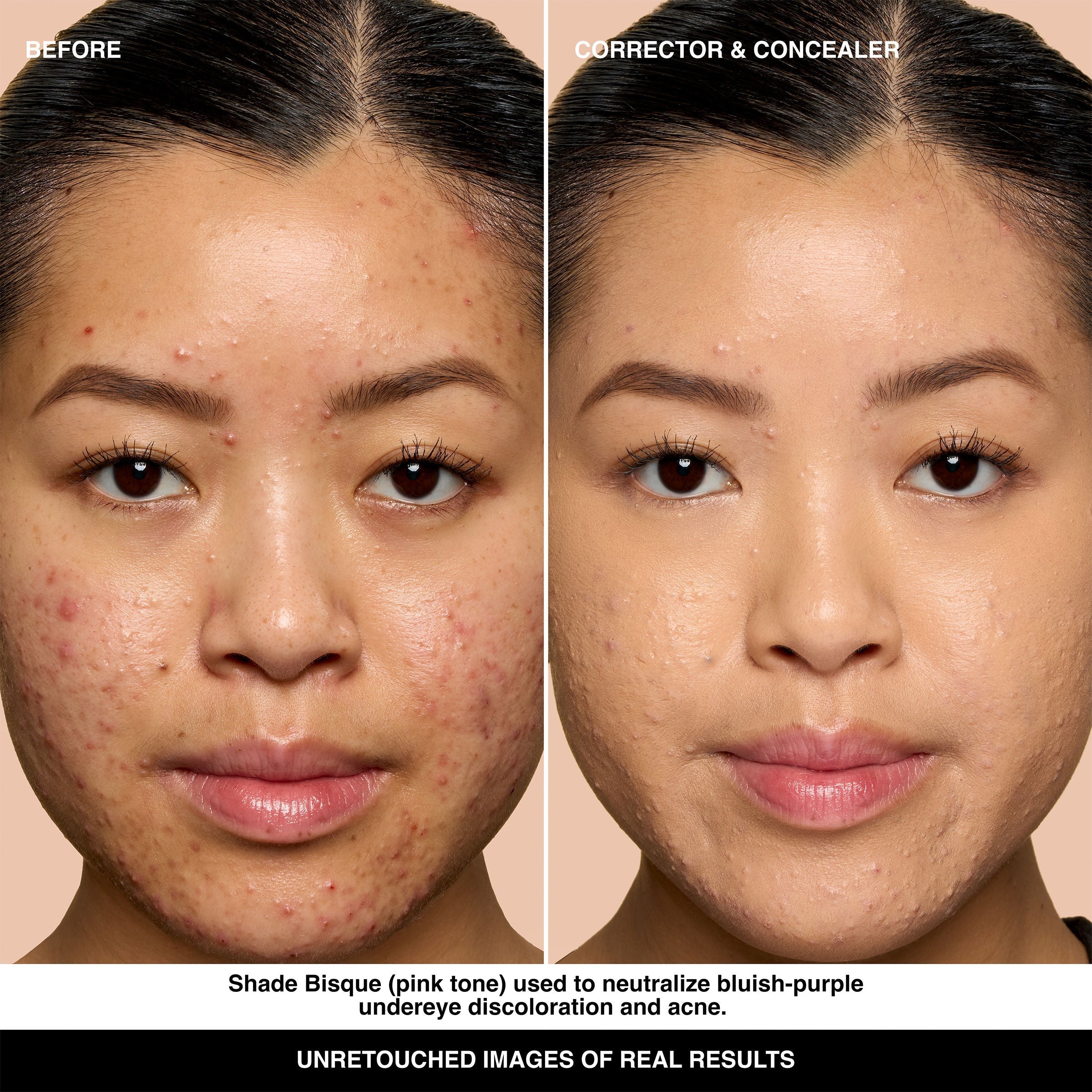 Skin Corrector Stick